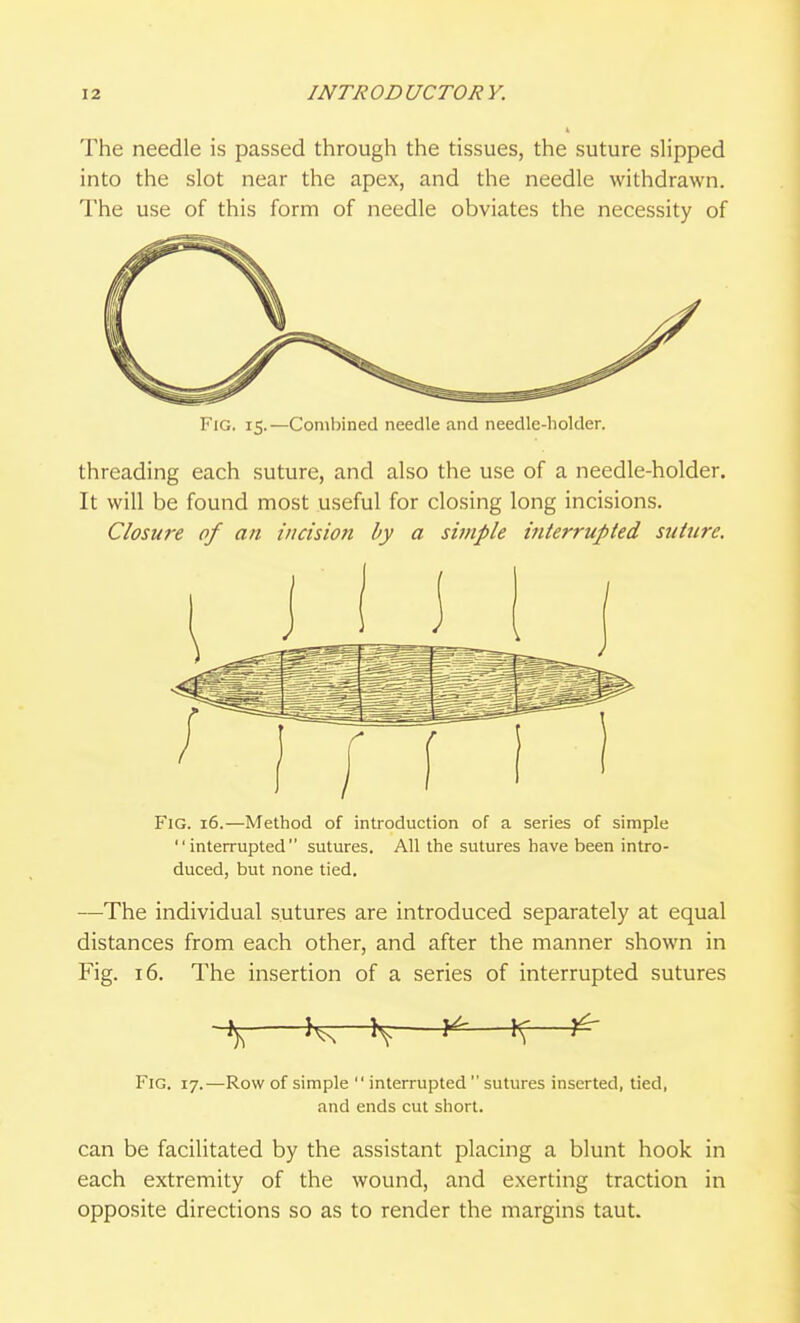 The needle is passed through the tissues, the suture slipped into the slot near the apex, and the needle withdrawn. The use of this form of needle obviates the necessity of Fig. 15.—Combined needle and needle-holder. threading each suture, and also the use of a needle-holder. It will be found most useful for closing long incisions. Closure of an incision by a simple interrupted suture. Fig. 16.—Method of introduction of a series of simple interrupted sutures. All the sutures have been intro- duced, but none tied. —The individual sutures are introduced separately at equal distances from each other, and after the manner shown in Fig. 16. The insertion of a series of interrupted sutures 4 -i^^ \^—If—^ Fig. 17.—Row of simple  interrupted  sutures inserted, tied, and ends cut short. can be facilitated by the assistant placing a blunt hook in each extremity of the wound, and exerting traction in opposite directions so as to render the margins taut.