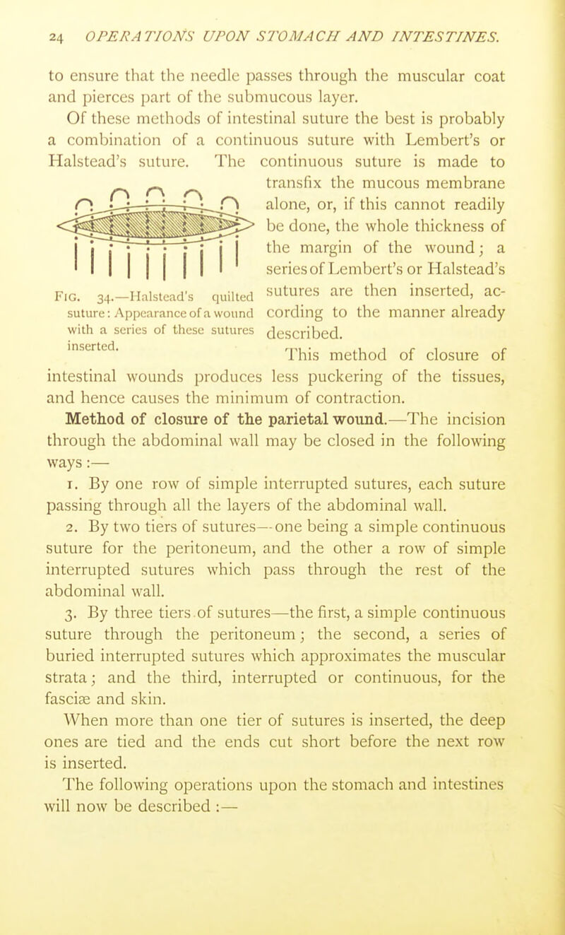 to ensure that the needle passes through the muscular coat and pierces part of the submucous layer. Of these methods of intestinal suture the best is probably a combination of a continuous suture with Lembert's or suture. The continuous suture is made to transfix the mucous membrane alone, or, if this cannot readily be done, the whole thickness of the margin of the wound; a series of Lembert's or Halstead's Fig. 34.-Halstcad's quilted ^^tures are then inserted, ac- suture: Appearance of a wound cording to the manner already with a scries of these sutures described. inserted. ™ . ,u a r i r This method of closure of intestinal wounds produces less puckering of the tissues, and hence causes the minimum of contraction. Method of closure of the parietal wound.—The incision through the abdominal wall may be closed in the following ways:— T. By one row of simple interrupted sutures, each suture passing through all the layers of the abdominal wall. 2. By two tiers of sutures—one being a simple continuous suture for the peritoneum, and the other a row of simple interrupted sutures which pass through the rest of the abdominal wall. 3. By three tiers .of sutures—the first, a simple continuous suture through the peritoneum j the second, a series of buried interrupted sutures which approximates the muscular strata; and the third, interrupted or continuous, for the fascise and skin. When more than one tier of sutures is inserted, the deep ones are tied and the ends cut short before the next row is inserted. The following oi^erations upon the stomach and intestines will now be described :—