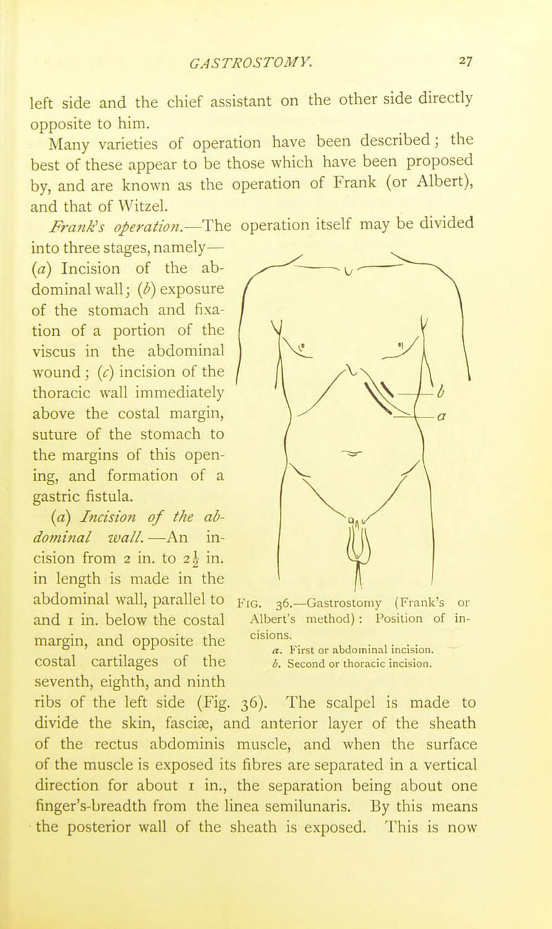 left side and the chief assistant on the other side directly opposite to him. Many varieties of operation have been described; the best of these appear to be those which have been proposed by, and are known as the operation of Frank (or Albert), and that of Witzel. Frank's operation.—The operation itself may be divided into three stages, namely— {a) Incision of the ab- dominal wall; exposure of the stomach and fixa- tion of a portion of the viscus in the abdominal wound ; (c) incision of the thoracic wall immediately above the costal margin, suture of the stomach to the margins of this open- ing, and formation of a gastric fistula. (a) Iticision of the ab- dominal ivall. —An in- cision from 2 in. to 2 J in. in length is made in the abdominal wall, parallel to Fig. 36.—Gastrostomy (Frank's or and I in. below the costal Albert's method): Position of in- margin, and opposite the costal cartilages of the seventh, eighth, and ninth ribs of the left side (Fig. 36). The scalpel is made to divide the skin, fasciae, and anterior layer of the sheath of the rectus abdominis muscle, and when the surface of the muscle is exposed its fibres are separated in a vertical direction for about i in., the separation being about one finger's-breadth from the linea semilunaris. By this means the posterior wall of the sheath is exposed. This is now cisions. a. First or abdominal incision. b. Second or thoracic incision.