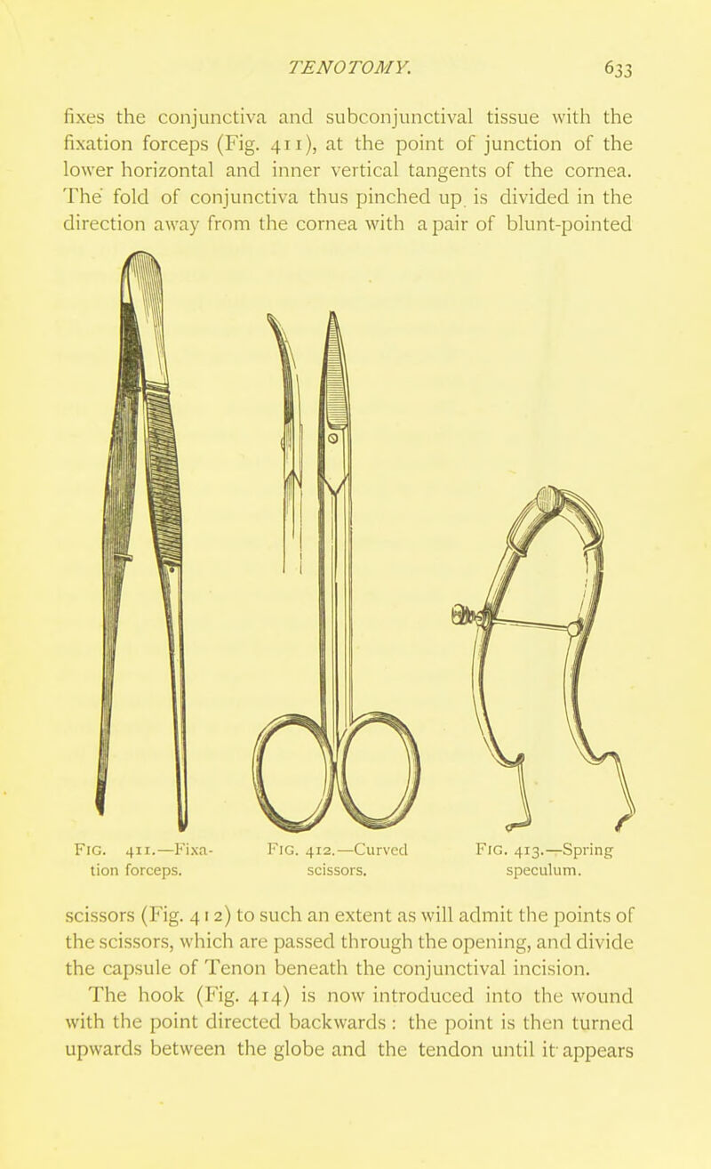 TENOTOMY. fixes the conjunctiva and subconjunctival tissue with the fixation forceps (Fig. 411), at the point of junction of the lower horizontal and inner vertical tangents of the cornea. The fold of conjunctiva thus pinched up is divided in the direction away from the cornea with a pair of blunt-pointed Fig. 411.—Fi.xa- Fig. 412.—Curved Fig. 413.—Spring lion forceps. scissors. speculum. scissors (Fig. 412) to such an extent as will admit the points of the scissors, which are passed through the opening, and divide the capsule of Tenon beneath the conjunctival incision. The hook (Fig. 414) is now introduced into the wound with the point directed backwards: the point is then turned upwards between the globe and the tendon until it- appears