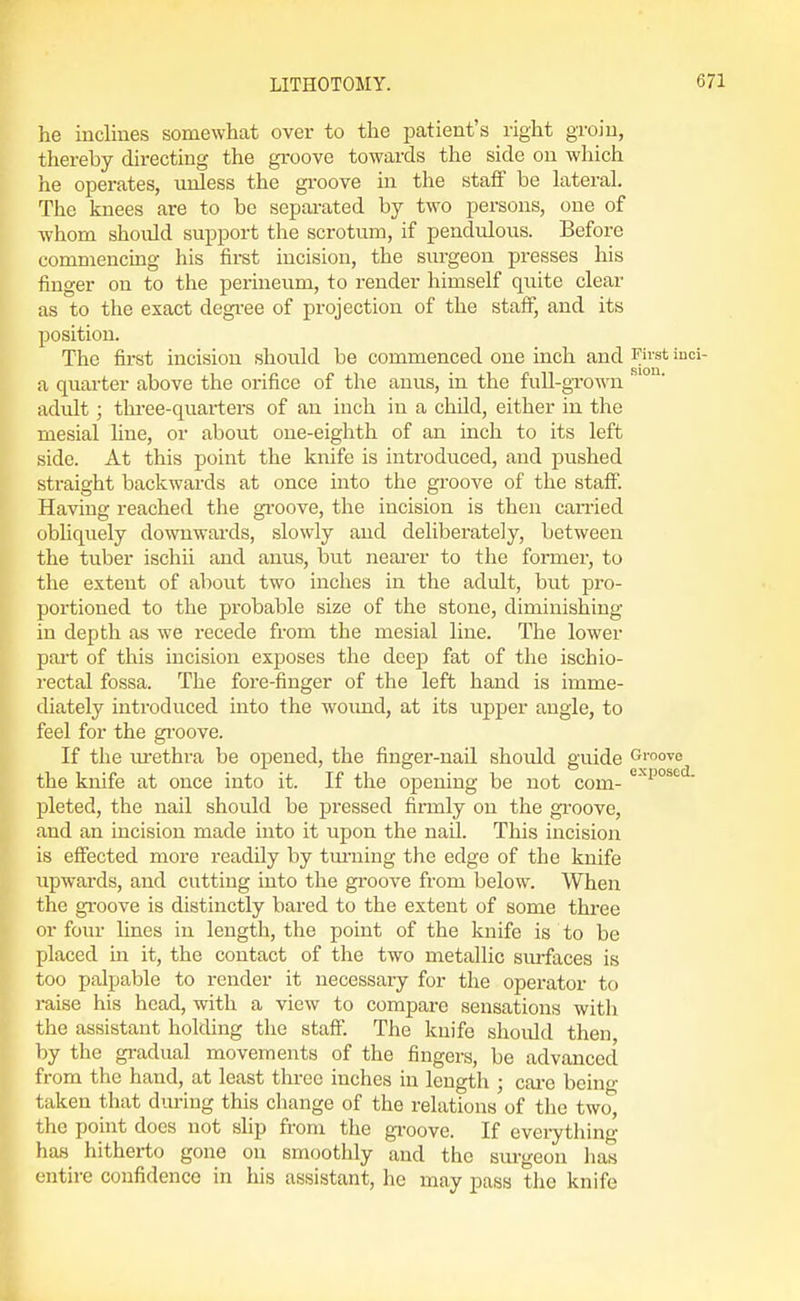 he inclines somewhat over to the patient's right groin, thereby directing the groove towards the side on which he operates, unless the groove in the staff be lateral. The knees are to be separated by two persons, one of whom shoidd support the scrotum, if pendulous. Before commencing his first incision, the surgeon presses his finger on to the perineum, to render himself quite clear as to the exact degi-ee of projection of the staff, and its position. The first incision shoiild be commenced one inch and First iuci- a quarter above the orifice of the anus, in the fuU-grown ' adult; thi-ee-quarters of an inch in a child, either in the mesial hue, or about one-eighth of an inch to its left side. At this point the knife is introduced, and pushed straight backwards at once into the groove of the staff. Having reached the gi-oove, the incision is then canied obliquely downwards, slowly and deliberately, between the tuber ischii and anus, but nearer to the former, to the extent of about two inches in the adult, but pro- portioned to the probable size of the stone, diminishing in depth as we recede from the mesial line. The lower part of this incision exposes the deep fat of the ischio- rectal fossa. The fore-finger of the left hand is imme- diately introduced into the wound, at its upper angle, to feel for the gi'oove. If the lu'ethra be opened, the finger-nail shoidd guide Groove the knife at once into it. If the opening be not com- '■'P''''^- pleted, the nail should be pressed firmly on the gi-oove, and an incision made into it upon the nail. This incision is effected more readily by tiu-ning the edge of the knife upwai'ds, and cutting into the gi-oove from below. When the gi'oove is distinctly bared to the extent of some three or four lines in length, the point of the knife is to be placed in it, the contact of the two metallic sm-faces is too palpable to render it necessary for the operator to raise his head, with a view to compare sensations with the assistant holding the staflT. The knife should then by the gradual movements of the fingers, be advanced from the hand, at least three inches in length ; cai-e bcino- taken that during this change of the relations of the two, the point docs not slip from the gi-oove. If everything has hitherto gone on smoothly and the surgeon lias entire confidence in his assistant, he may pass the knife