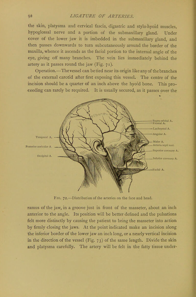 the skin, platysma and cervical fascia, digastric and stylo-hyoid muscles, hypoglossal nerve and a portion of the submaxillary gland. Under cover of the lower jaw it is imbedded in the submaxillary gland, and then passes downwards to turn subcutaneously around the border of the maxilla, whence it ascends as the facial portion to the internal angle of the eye, giving off many branches. The vein lies immediately behind the artery as it passes round the jaw (Fig. 71). Operation.—The vessel can be tied near its origin like any of the branches of the external carotid after first exposing this vessel. The centre of the incision should be a quarter of an inch above the hyoid bone. This pro- ceeding can rarely be required. It is usually secured, as it passes over the Temporal A, Posterior auricular A. Occipital A. Supra-orbital A, Frontal A. Lachrymal A. Ang^ilar A. Malar A. Arteria septi nasi. Superior coronarj' A. Inferior coronary A. Facial A. Fig. 72.—Distribution of the arteries on the face and head. ramus of the jaw, in a groove just in front of the masseter, about an inch anterior to the angle. Its position will be better defined and the pulsations felt more distinctly by causing the patient to bring the masseter into action by firmly closing the jaws. At the point indicated make an incision along the inferior border of the lower jaw an inch long, or a nearly vertical incision in the direction of the vessel (Fig. 73) of the same length. Divide the skin and platysma carefully. The artery will be felt in the fatty tissue under-