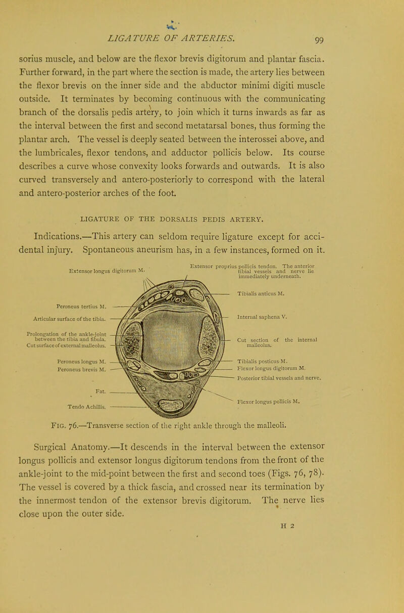 soriiis muscle, and below are the flexor brevis digitorum and plantar fascia. Further forward, in the part where the section is made, the artery lies between the flexor brevis on the inner side and the abductor minimi digiti muscle outside. It terminates by becoming continuous with the communicating branch of the dorsalis pedis arteVy, to join which it turns inwards as far as the interval between the first and second metatarsal bones, thus forming the plantar arch. The vessel is deeply seated between the interossei above, and the lumbricales, flexor tendons, and adductor poUicis below. Its course describes a cur\'e whose convexity looks forwards and outwards. It is also curved transversely and antero-posteriorly to correspond with the lateral and antero-posterior arches of the foot. LIGATURE OF THE DORSALIS PEDIS ARTERY. Indications.—This artery can seldom require ligature except for acci- dental injury. Spontaneous aneurism has, in a few instances, formed on it. Extensor longus digitorvmi M. Peroneus tertius M. Articular surface of the tibia. Prolongation of the ankle-joint between the tibia and fibula. Cut surface of external malleolus. Peroneus longus M. Peroneus brevis M. Fat. Tendo Achillis. Extensor proprius iiollicis tendon. The anterior tibial vessels and nerve lie immediately underneath. Tibialis anticus M. — Internal saphena V. Cut section of the internal malleolus. Tibialis posticus M. Flexor longus digitorum M. Posterior tibial vessels and nerve. Flexor longus poUicis M. Fig. 76.—Transverse section of the right ankle through the malleoli. Surgical Anatomy.—It descends in the interval between the extensor longus poUicis and extensor longus digitorum tendons from the front of the ankle-joint to the mid-point between the first and second toes (Figs. 76, 78). The vessel is covered by a thick fascia, and crossed near its termination by the innermost tendon of the extensor brevis digitorum. The nerve lies close upon the outer side. H 2