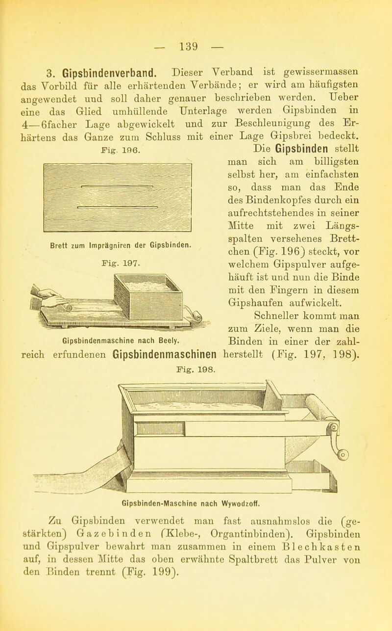 Fig. 196. 3. Gipsbindenverband. Dieser Verband ist gewissermassen das Vorbild für alle erhärtenden Verbände; er wird am häufigsten angewendet und soll daher genauer beschrieben werden. Ueber eine das Glied umhüllende Unterlage werden Gipsbinden in 4—ßfacher Lage abgewickelt und zur Beschleunigung des Er- härtens das Ganze zum Schluss mit einer Lage Gipsbrei bedeckt. Die Gipsbinden stellt man sich am billigsten selbst her, am einfachsten so, dass man das Ende des Bindenkopfes durch ein aufrechtstehendes in seiner Mitte mit zwei Längs- spalten versehenes Brett- chen (Fig. 196) steckt, vor welchem Gipspulver aufge- häuft ist und nun die Binde mit den Fingern in diesem Gipshaufen aufwickelt. Schneller kommt man zum Ziele, wenn man die Gipsbindenmaschine nach Beely. Binden in einer der zahl- reich erfundenen Gipsbindenmaschinen herstellt (Fig. 197, 198). Fig. 198. Brett zum Imprägniren der Gipsbinden. Fig. 197. Gipsbinden-Maschine nach Wywodzoff. Zu Gipsbinden verwendet man fast ausnahmslos die (ge- stärkten) Gazebinden fKlebe-, Organtinbinden). Gipsbinden und Gipspulver bewahrt man zusammen in einem Blech kästen auf, in dessen Mitte das oben erwähnte Spaltbrett das Pulver von den Rinden trennt (Fig. 199).