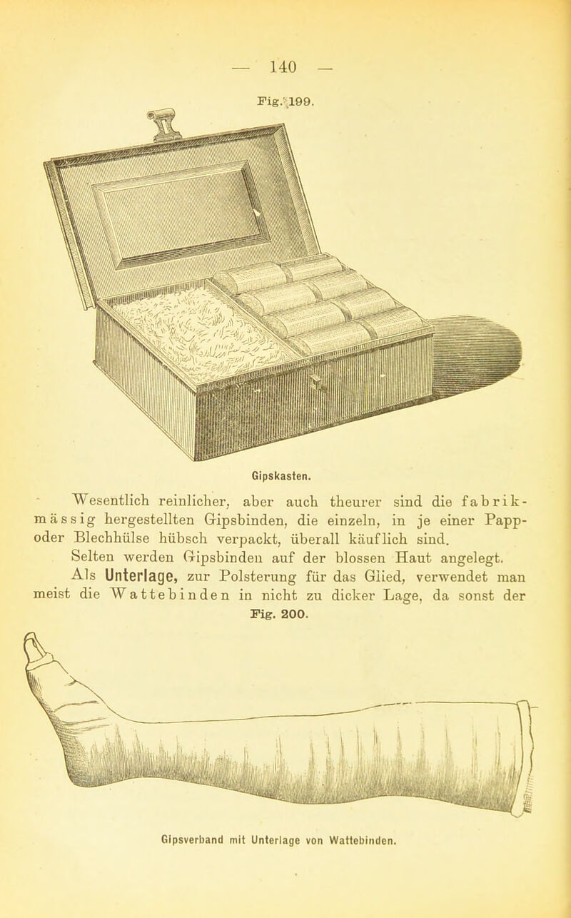 Fig.--.199. Gipskasten. Wesentlich reinlicher, aber auch theurer sind die fabrik- mässig hergestellten Gipsbinden, die einzeln, in je einer Papp- oder Blechhülse hübsch verpackt, überall käuflich sind. Selten werden Gipsbinden auf der blossen Haut angelegt. Als Unterlage, zur Polsterung für das Glied, verwendet man meist die Wattebinden in nicht zu dicker Lage, da sonst der Fig. 200. Gipsverband mit Unterlage von Wattebinden.