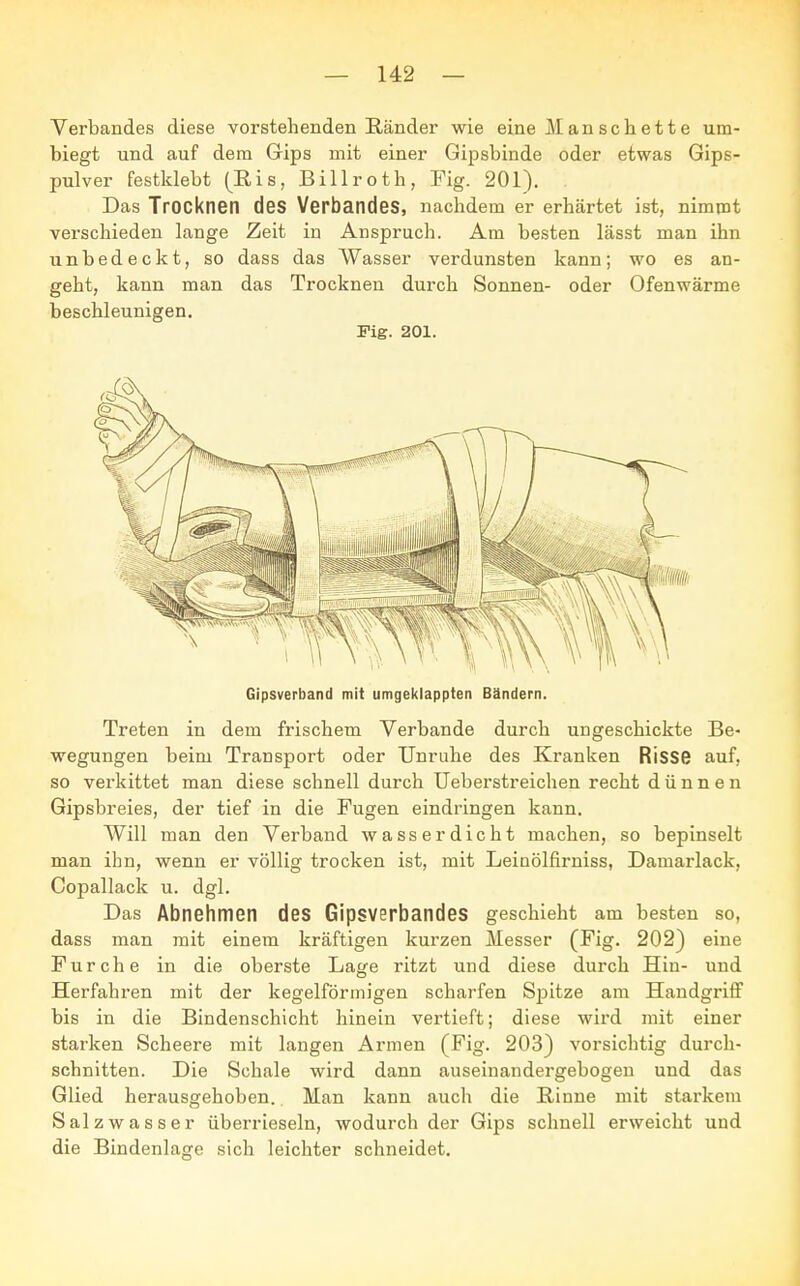 Verbandes diese vorstehenden Ränder wie eine M an sch e 11 e um- biegt und auf dem Gips mit einer Gipsbinde oder etwas Gips- pulver festklebt (Eis, Billroth, Fig. 201). Das Trocknen des Verbandes, nachdem er erhärtet ist, nimmt verschieden lange Zeit in Anspruch. Am besten lässt man ihn unbedeckt, so dass das Wasser verdunsten kann; wo es an- geht, kann man das Trocknen durch Sonnen- oder Ofenwärme beschleunigen. Fig. 201. Gipsverband mit umgeklappten Bändern. Treten in dem frischem Verbände durch ungeschickte Be- wegungen beim Transport oder Unruhe des Kranken Risse auf, so verkittet man diese schnell durch Ueberstreichen recht dünnen Gipsbreies, der tief in die Fugen eindringen kann. Will man den Verband wasserdicht machen, so bepinselt man ihn, wenn er völlig trocken ist, mit Leinölfirniss, Damarlack, Copallack u. dgl. Das Abnehmen des Gipsverbandes geschieht am besten so, dass man mit einem kräftigen kurzen Messer (Fig. 202) eine Furche in die oberste Lage ritzt und diese durch Hin- und Herfahren mit der kegelförmigen scharfen Spitze am Handgriff bis in die Bindenschicht hinein vertieft; diese wird mit einer starken Scheere mit langen Armen (Fig. 203) vorsichtig durch- schnitten. Die Schale wird dann auseinandergebogen und das Glied herausgehoben. Man kann auch die Rinne mit starkem Salzwasser überrieseln, wodurch der Gips schnell erweicht und die Bindenlage sich leichter schneidet.