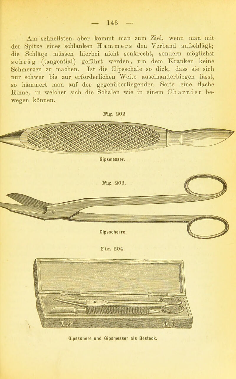 Am schnellsten aber kommt man zum Ziel, wenn man mit der Spitze eines schlanken Hammers den Verband aufschlägt; die Schläge müssen hierbei nicht senkrecht, sondern möglichst schräg (tangential) geführt werden, um dem Kranken keine Schmerzen zu machen. Ist die Gipsschale so dick, dass sie sich nur schwer bis zur erforderlichen Weite auseinanderbiegen lässt, so hämmert man auf der gegenüberliegenden Seite eine flache Rinne, in welcher sich die Schalen wie in einem Charnier be- wegen können. Fig. 202. Gipsschere und Gipsmesser als Besteck.