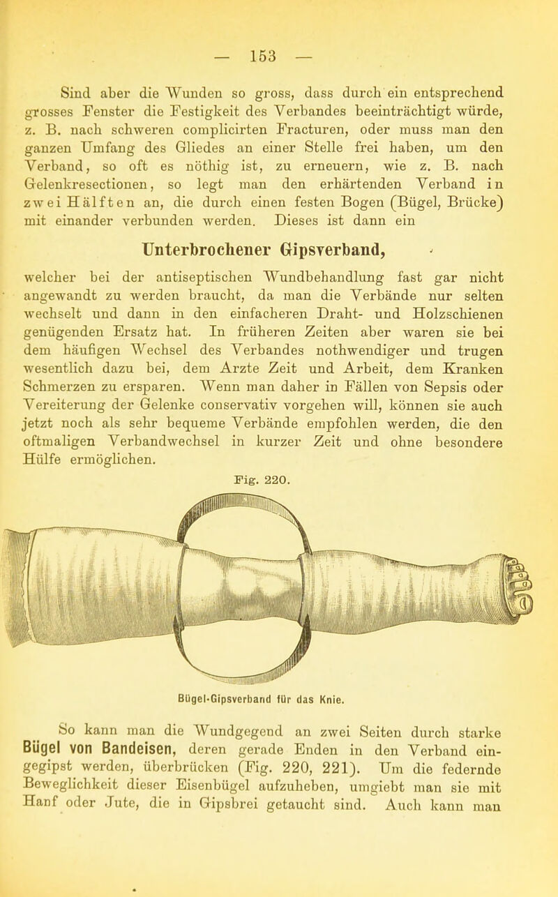 Sind aber die Wunden so gross, dass durch ein entsprechend grosses Fenster die Festigkeit des Verbandes beeinträchtigt würde, z. B. nach schweren complicirten Fracturen, oder rnuss man den ganzen Umfang des Gliedes an einer Stelle frei haben, um den Verband, so oft es nöthig ist, zu erneuern, wie z. B. nach Gelenkresectionen, so legt man den erhärtenden Verband i n zwei Hälften an, die durch einen festen Bogen (Bügel, Brücke) mit einander verbunden werden. Dieses ist dann ein Unterbrochener Gipsverband, welcher bei der antiseptischen Wundbehandlung fast gar nicht angewandt zu werden braucht, da man die Verbände nur selten wechselt und dann in den einfacheren Draht- und Holzschienen genügenden Ersatz hat. In früheren Zeiten aber waren sie bei dem häufigen Wechsel des Verbandes nothwendiger und trugen wesentlich dazu bei, dem Arzte Zeit und Arbeit, dem Kranken Schmerzen zu ersparen. Wenn man daher in Fällen von Sepsis oder Vereiterung der Gelenke conservativ vorgehen will, können sie auch jetzt noch als sehr bequeme Verbände empfohlen werden, die den oftmaligen Verbandwechsel in kurzer Zeit und ohne besondere Hülfe ermöglichen. Fig. 220. Bügel-Gipsverband für das Knie. So kann man die Wundgegend an zwei Seiten durch starke Bügel von Bandeisen, deren gerade Enden in den Verband ein- gegipst werden, überbrücken (Fig. 220, 221). Um die federnde Beweglichkeit dieser Eisenbügel aufzuheben, umgiebt man sie mit Hanf oder Jute, die in Gipsbrei getaucht sind. Auch kann man