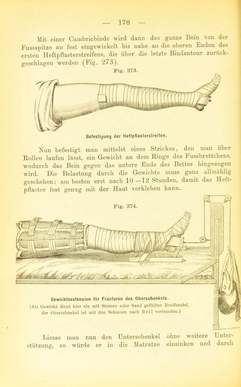 Mit einer Cauibricbinde wird dann das ganze Bein von der Fussspitze an fest eingewickelt bis nahe an die oberen Enden des ersten Heftpflasterstreifens, die über die letzte Bindentour zurück- geschlagen werden (Fig. 273). Fig. 273. Befestigung der Heftpflasterstreifen. Nun befestigt man mittelst eines Strickes, den man über Rollen laufen lässt, ein Gewicht an dem Ringe des Fussbrettchens. wodurch das Bein gegen das untere Ende des Bettes hingezogen wird. Die Belastung durch die Gewichte muss ganz allmählig geschehen; am besten erst nach 10—12 Stunden, damit das Heft- pflaster fest genug mit der Haut verkleben kann. Liesse man nun den Unterschenkel ohne weitere Unter- stützung, so würde er in die Matratze einsinken und durch
