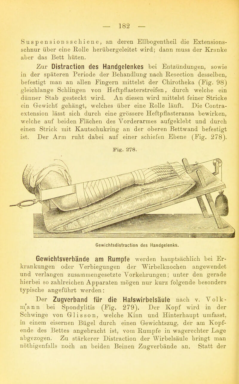 Suspensionsschiene, an deren Ellbogentheil die Extensions- schnur über eine Rolle herübergeleitet wird; dann muss der Kranke aber das Bett hüten. Zur Distraction des Handgelenkes bei Entzündungen, sowie in der späteren Periode der Behandlung nach Resection desselben, befestigt man an allen Fingern mittelst der Chirotheka (Fig. 98) gleichlange Schlingen von Heftpflasterstreifen, durch welche ein dünner Stab gesteckt wird. An diesen wird mittelst feiner Stricke ein Gewicht gehängt, welches über eine Bolle läuft. Die Contra- extension lässt sich durch eine grössere Heftpflasteransa bewirken, welche auf beiden Flächen des Vorderarmes aufgeklebt und durch einen Strick mit Kautschukring an der oberen Bettwand befestigt ist. Der Arm ruht dabei auf einer schiefen Ebene (Fig. 278). Fig. 278. Gewichtsdistraction des Handgelenks. Gewichtsverbände am Rumpfe werden hauptsächlich bei Er- krankungen oder Verbiegungen der Wirbelknochen angewendet und verlangen zusammengesetzte Vorkehrungen; unter den gerade hierbei so zahlreichen Apparaten mögen nur kurz folgende besonders typische angeführt werden: Der Zugverband für die Halswirbelsäule nach v. Volk- n/ann bei Spondylitis (Fig. 279). Der Kopf wird in der Schwinge von Glisson, welche Kinn und Hinterhaupt umfasst. in einem eisernen Bügel durch einen Gewichtszug, der am Kopf- ende des Bettes angebracht ist, vom Rumpfe iu wagerechter Lage abgezogen. Zu stärkerer Distraction der Wirbelsäule bringt man nöthigenfalls noch an beiden Beinen Zugverbände an. Statt der