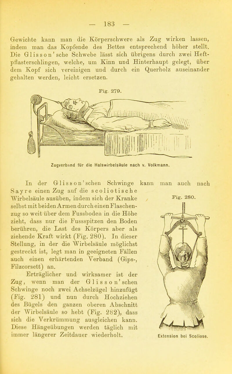 Gewichte kann man die Körperschwere als Zug wirken lassen, indem man das Kopfende des Bettes entsprechend höher stellt. Die Glisson'sehe Schwebe lässt sich übrigens durch zwei Heft- pHasterschlingen, welche, um Kinn und Hinterhaupt gelegt, über dem Kopf sich vereinigen und durch ein Querholz auseinander gehalten werden, leicht ersetzen. Fig. 279. Zugverband für die Halswirbelsäule nach v. Volkmann. In der Glisson' sehen Schwinge Sayre einen Zug auf die scoliotische Wirbelsäule ausüben, indem sich der Kranke selbst mit beiden Armen durch einen Flaschen- zug so weit über dem Fussboden in die Höhe zieht, dass nur die Fussspitzen den Boden berühren, die Last des Körpers aber als ziehende Kraft wirkt (Fig. 280). In dieser Stellung, in der die Wirbelsäule möglichst gestreckt ist, legt man in geeigneten Fällen auch einen erhärtenden Verband (Gips-, Filzcorsett) an. Erträglicher und wirksamer ist der kann man auch nach Zug, 6 wenn man der Glisson' sehen Schwinge noch zwei Achselzügel hinzufügt (Fig. 281) und nun durch Hochziehen des Bügels den ganzen oberen Abschnitt der AVirbelsäule so hebt (Fig. 282), dass sich die Verkrümmung ausgleichen kann. Diese Hängeübungen werden täglich mit immer längerer Zeitdauer wiederholt. Extension bei Scoliose.