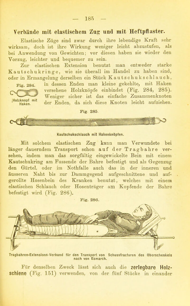 Verbände mit elastischem Zug und mit Heftpflaster. Elastische Züge sind zwar durch ihre lebendige Kraft sehr wirksam, doch ist ihre Wirkung weniger leicht abzustufen, als bei Anwendung von Gewichten; vor diesen haben sie wieder den Vorzug, leichter und bequemer zu sein. Zur elastischen Extension benutzt man entweder starke Kautschukringe, wie sie überall im Handel zu haben sind, oder in Ermangelung derselben ein Stück Kautschukschlauch, Fig. 284. in dessen Enden man kleine gekehlte, mit Haken P^^m^Ä versehene Holzknöpfe einbindet (Fig. 284, 285). -ä*^ Weniger sicher ist das einfache Zusammenknoten lH0UHSken.mit der Enden, da sich diese Knoten leicht aufziehen. Fig. 285. Kautschukschlauch mit Hakenknöpfen. Mit solchem elastischen Zug kann man Verwundete bei länger dauerndem Transport schon auf der Tragbahre ver- sehen, indem man das sorgfältig eingewickelte Bein mit einem Kautschukring am Fussende der Bahre befestigt und als Gegenzug den Gürtel, oder im Nothfalle auch das in der inneren und äusseren Naht bis zur Dammgegend aufgeschnittene und auf- gerollte Hosenbein des Kranken benutzt, welches mit einem elastischen Schlauch oder Hosenträger am Kopfende der Bahre befestigt wird (Fig. 286). Fig. 286. Tragbahren-Extensions-Verband für den Transport von Schussfracturen des Oberschenkels nach von Esmarch. Für denselben Zweck lässt sich auch die zerlegbare Holz- SChiene (Fig. 151) verwenden, von der fünf Stücke in einander