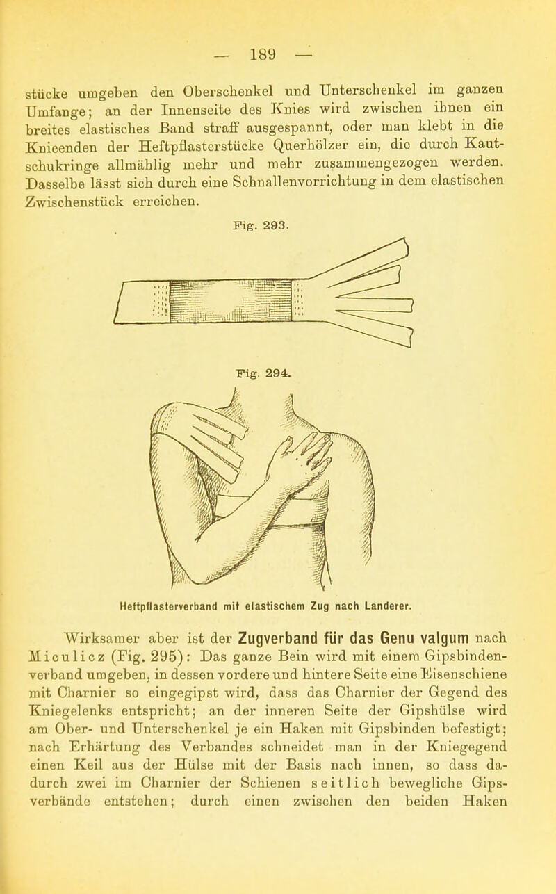 stücke umgeben den Oberschenkel und Unterschenkel im ganzen Umfange; an der Innenseite des Knies wird zwischen ihnen ein breites elastisches Band straff ausgespannt, oder man klebt in die Knieenden der Heftpflasterstücke Querhölzer ein, die durch Kaut- schukringe allmählig mehr und mehr zusammengezogen werden. Dasselbe lässt sich durch eine Schnallenvorrichtung in dem elastischen Zwischenstück erreichen. Fig. 293. Heftpflasterverband mit elastischem Zug nach Landerer. Wirksamer aber ist der Zugverband für das Genu valgum nach Miculicz (Fig. 295): Das ganze Bein wird mit einem Gipsbinden- verband umgeben, in dessen vordere und hintere Seite eine Eisenschiene mit Cliarnier so eingegipst wird, dass das Charnier der Gegend des Kniegelenks entspricht; an der inneren Seite der Gipshülse wird am Ober- und Unterschenkel je ein Haken mit Gipsbinden befestigt; nach Erhärtung des Verbandes schneidet man in der Kniegegend einen Keil aus der Hülse mit der Basis nach innen, so dass da- durch zwei im Charnier der Schienen seitlich bewegliche Gips- verbände entstehen; durch einen zwischen den beiden Haken