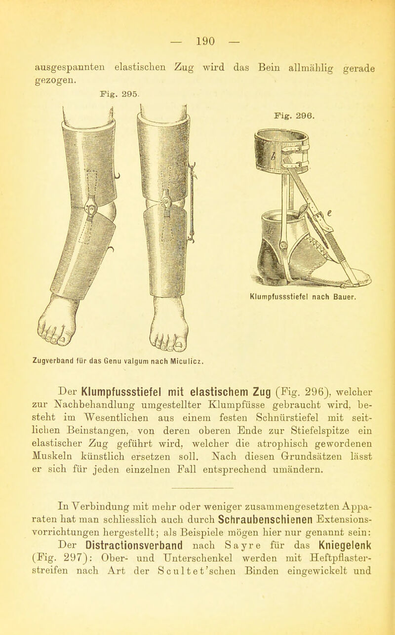 ausgespannten elastischen Zug wird das Bein allmählig gerade gezogen. Fig. 295. Zugverband für das Genu valgum nach Miculicz. Der Klumpfussstiefel mit elastischem Zug (Fig. 296), welcher zur Nachbehandlung umgestellter Klumpfüsse gebraucht wird, be- steht im Wesentlichen aus einem festen Schnürstiefel mit seit- lichen Beinstangen, von deren oberen Ende zur Stiefelspitze ein elastischer Zug geführt wird, welcher die atrophisch gewordenen Muskeln künstlich ersetzen soll. Nach diesen Grundsätzen lässt er sich für jeden einzelnen Fall entsprechend umändern. In Verbindung mit mehr oder weniger zusammengesetzten Ajjpa- raten hat man schliesslich auch durch Sc h raube Ii SC Iii eil eil Extensions- vorrichtungen hergestellt; als Beispiele mögen hier nur genannt sein: Der Distractionsverband nach Sayre für das Kniegelenk (Fig. 297): Ober- und Unterschenkel werden mit Heftpflaster- streifen nach Art der S c u 11 e t'sehen Binden eingewickelt und