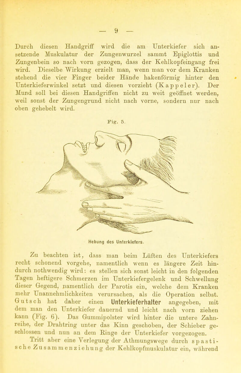 setzende Muskulatur der Zungenwurzel sammt Epiglottis und Zungenbein so nach vorn gezogen, dass der Kehlkopfeingang frei wird. Dieselbe Wirkung erzielt man, wenn man vor dem Kranken stehend die vier Finger beider Hände hakenförmig liinter den TJnterkieferwinkel setzt und diesen vorzieht (Kappe 1er}. Der Mund soll bei diesen Handgriffen nicht zu weit geöffnet werden, weil sonst der Zungengrund nicht nach vorne, sondern nur nach oben gehebelt wird. Fig. 5. Hebung des Unterkiefers. Zu beachten ist, dass man beim Lüften des Unterkiefers recht schonend vorgehe, namentlich wenn es längere Zeit hin- durch nothwendig wird: es stellen sich sonst leicht in den folgenden Tagen heftigere Schmerzen im Unterkiefergelenk und Schwellung dieser Gegend, pamentlich der Parotis ein, welche dem Kranken mehr Unannehmlichkeiten verursachen, als die Operation selbst. Gutsch hat daher einen Unterkieferhalter angegeben, mit dem man den Unterkiefer dauernd und leicht nach vorn ziehen kann (Fig. 6). Das Gummipolster wird hinter die untere Zahn- reihe, der Drahtring unter das Kinn geschoben, der Schieber ge- schlossen und nun an dem Einge der Unterkiefer vorgezogen. Tritt aber eine Verlegung der Athmungswege durch spasti- sche Zusammenziehung der Kehlkopfmuskulatur ein, während