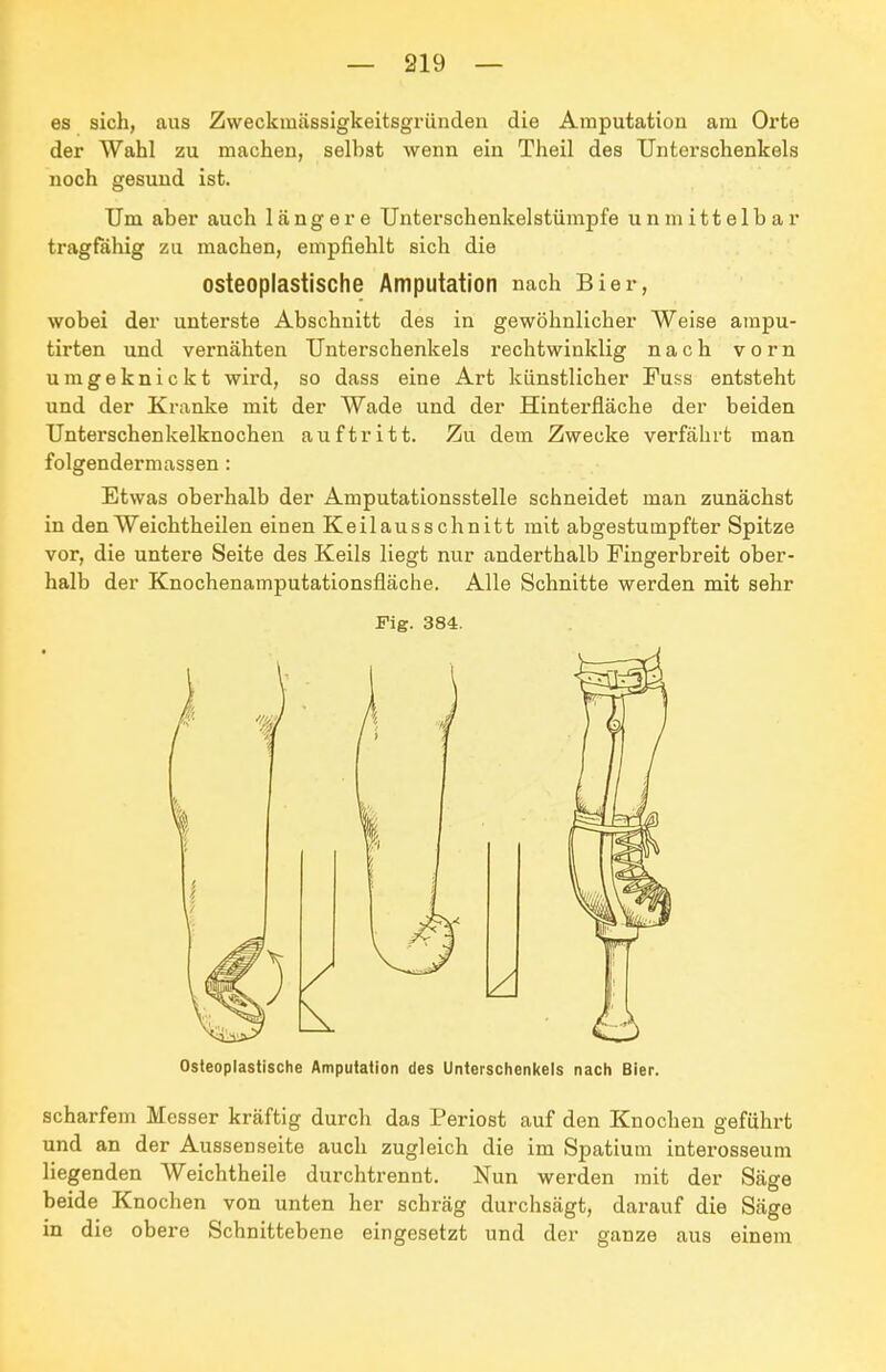 es sich, aus Zweckmässigkeitsgründen die Amputation am Orte der Wahl zu machen, selbst wenn ein Theil des Unterschenkels noch gesund ist. Um aber auch längere Unterschenkelstümpfe unmittelbar tragfahig zu machen, empfiehlt sich die osteoplastische Amputation nach Bier, wobei der unterste Abschnitt des in gewöhnlicher Weise ampu- tirten und vernähten Unterschenkels rechtwinklig nach vorn umgeknickt wird, so dass eine Art künstlicher Fuss entsteht und der Kranke mit der Wade und der Hinterfläche der beiden Unterschenkelknochen auftritt. Zu dem Zwecke verfährt man folgendermassen : Etwas oberhalb der Amputationsstelle schneidet man zunächst in denWeichtheilen einen Keilausschnitt mit abgestumpfter Spitze vor, die untere Seite des Keils liegt nur anderthalb Fingerbreit ober- halb der Knochenamputationsfläche. Alle Schnitte werden mit sehr Fig. 384. Osteoplastische Amputation des Untersctienkels nacti Bier. scharfem Messer kräftig durch das Periost auf den Knochen geführt und an der Aussenseite auch zugleich die im Spatium interosseum liegenden Weichtheile durchtrennt. Nun werden mit der Säge beide Knochen von unten her schräg durchsägt, darauf die Säge in die obere Schnittebene eingesetzt und der ganze aus einem