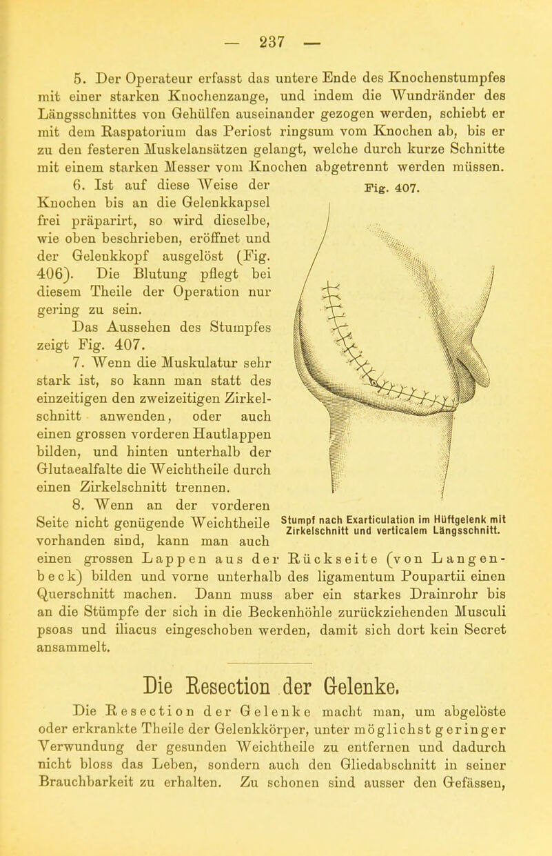 Fig. 407. 5. Der Operateur erfasst das untere Ende des Knochenstumpfes mit einer starken Knochenzange, und indem die Wundränder des Längsschnittes von Gehülfen auseinander gezogen werden, schiebt er mit dem Raspatorium das Periost ringsum vom Knochen ab, bis er zu den festeren Muskelansätzen gelangt, welche durch kurze Schnitte mit einem starken Messer vom Knochen abgetrennt werden müssen. 6. Ist auf diese Weise der Knochen bis an die Gelenkkapsel frei präparirt, so wird dieselbe, wie oben beschrieben, eröflfnet und der Gelenkkopf ausgelöst (Fig. 406). Die Blutung pflegt bei diesem Theile der Operation nur gering zu sein. Das Aussehen des Stumpfes zeigt Fig. 407. 7. Wenn die Muskulatur sehr stark ist, so kann man statt des einzeitigen den zweizeitigen Zirkel- schnitt anwenden, oder auch einen grossen vorderen Hautlappen bilden, und hinten unterhalb der Glutaealfalte die Weichtheile durch einen Zirkelschnitt trennen. 8. Wenn an der vorderen Seite nicht genügende Weichtheile vorhanden sind, kann man auch einen grossen Lappen aus der Rückseite (von Langen- b e c k) bilden und vorne unterhalb des ligamentum Poupartii einen Querschnitt machen. Dann muss aber ein starkes Drainrohr bis an die Stümpfe der sich in die Beckenhöhle zurückziehenden Musculi psoas und iliacus eingeschoben werden, damit sich dort kein Secret ansammelt. stumpf nach Exariiculation im Hüftgelenk mit Zirkelschnitt und verticalem Längsschnitt. Die Eesection der Gelenke. Die Resection der Gelenke macht man, um abgelöste oder erkrankte Theile der Gelenkkörper, unter möglichst geringer Verwundung der gesunden Weichtheile zu entfernen und dadurch nicht bloss das Leben, sondern auch den Gliedabschnitt in seiner Brauchbarkeit zu erhalten. Zu schonen sind ausser den Gefässen,