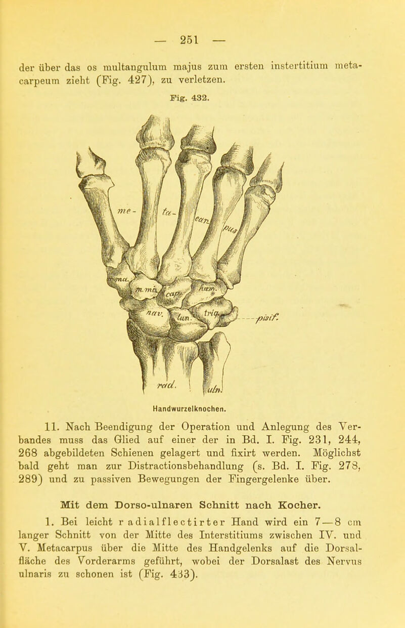 — 261 — der über das os miiltaugulum majus zum ersten instertitium meta carpeum zieht (Fig. 427), zu verletzen. Fig. 432. Handwurzelknochen. 11. Nach Beendigung der Operation und Anlegung des Ver- bandes muss das Glied auf einer der in Bd. I. Fig. 231, 244, 268 abgebildeten Schienen gelagert und fixirt werden. Möglichst bald geht man zur Distractionsbehandlung (s. Bd. I. Fig. 278, 289) und zu passiven Bewegungen der Fingergelenke über. Mit dem Dorso-ulnaren Schnitt nach Kocher. 1. Bei leicht r adialflectirter Hand wird ein 7 — 8 cm langer Schnitt von der Mitte des Interstitiums zwischen IV. und V. Metacarpus über die Mitte des Handgelenks auf die Dorsal- fläche des Vorderarms geführt, wobei der Dorsalast des Nervus ulnaris zu schonen ist (Fig. 433).