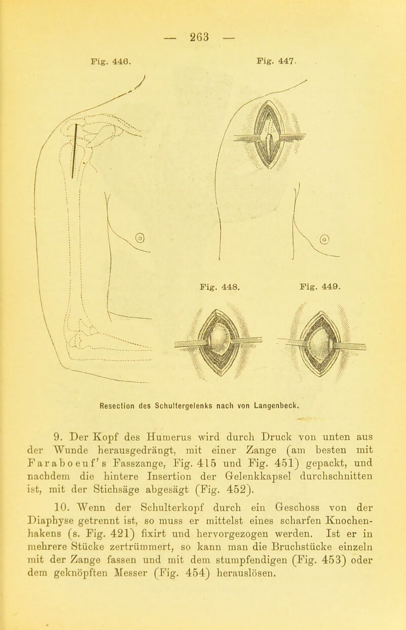 Fig. 446. Pig. 447. Resection des Schultergelenks nach von Langenbeck. 9. Der Kopf des Humerus wird durch Druck von unten aus der Wunde herausgedrängt, mit einer Zange (am besten mit Faraboeuf's Fasszange, Fig. 415 und Fig. 451) gepackt, und nachdem die hintere Insertion der Gelenkkapsel durchschnitten ist, mit der Stichsäge abgesägt (Fig. 452). 10. Wenn der Schulterkopf durch ein Geschoss von der Diaphyse getrennt ist, so muss er mittelst eines scharfen Knochen- hakens (s. Fig. 421) fixirt und hervorgezogen werden. Ist er in mehrere Stücke zertrümmert, so kann man die Bruchstücke einzeln mit der Zange fassen und mit dem stumpfendigen (Fig. 453) oder dem geknöpften Messer (Fig. 454) herauslösen.