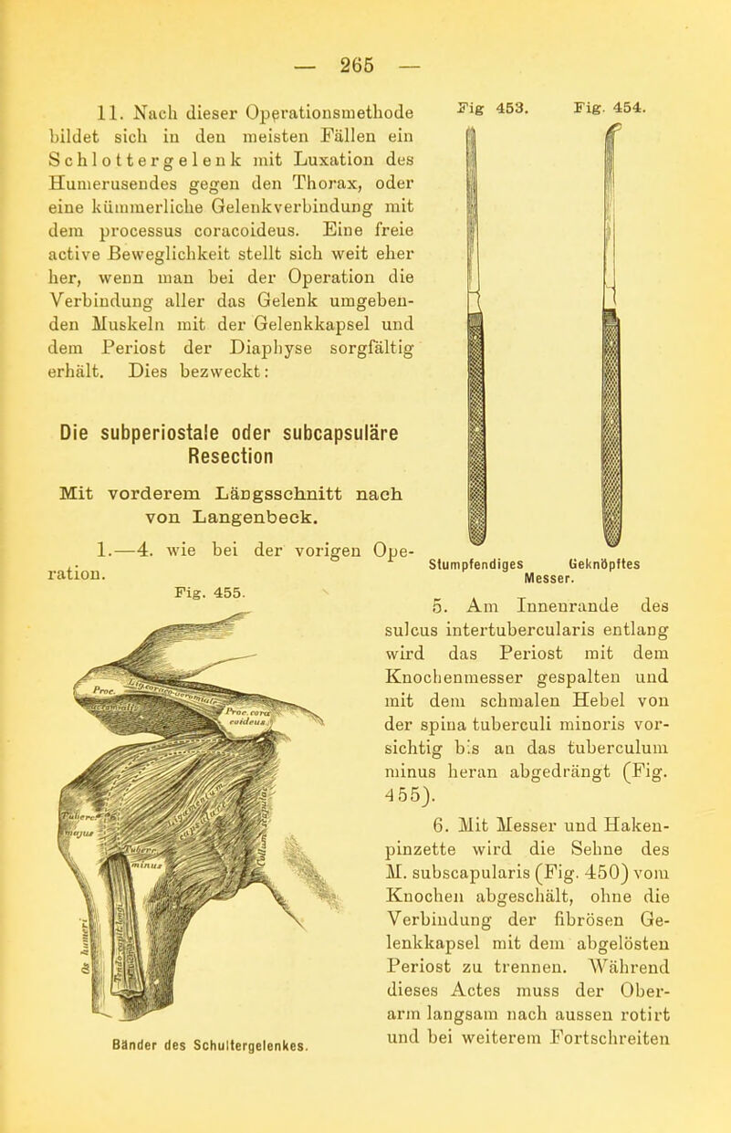 11. Nach dieser Op^rationsmethode bildet sich iu deu meisten Fällen ein Schlottergelenk mit Luxation des Humerusendes gegen den Thorax, oder eine kümmerliche Gelenkverbindung mit dem Processus coracoideus. Eine freie active Beweglichkeit stellt sich weit eher her, wenn man bei der Operation die Verbindung aller das Gelenk umgeben- den Muskeln mit der Gelenkkapsel und dem Periost der Diaphyse sorgfältig erhält. Dies bezweckt: yig 453. Fig. 454. Die subperiostale oder subcapsuläre Resection Mit vorderem Längsschnitt nach von Langenbeek. 1.—4. wie bei der vorigen Ope- ration. Fig. 455. Stumpfendiges üeknöpftes Messer. Bänder des Schultergelenkes. 5. Am Innenrande des sulcus intertubercularis entlang wird das Periost mit dem Knochenmesser gespalten und mit dem schmalen Hebel von der Spina tuberculi minoris vor- sichtig bis an das tuberculum minus heran abgedrängt (Fig. 455). 6. Mit Messer und Haken- pinzette wird die Sehne des M. subscapularis (Fig. 450) vom Knochen abgeschält, ohne die Verbindung der fibrösen Ge- lenkkapsel mit dem abgelösten Periost zu trennen. Während dieses Actes muss der Ober- arm langsam nach aussen rotirt und bei weiterem Fortschreiten