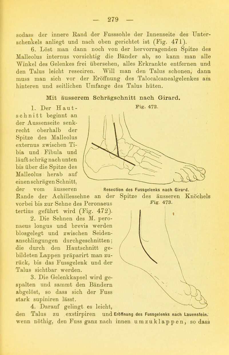 sodass der innere Rand der Fusssohle der Innenseite des Unter- schenkels anliegt und nach oben gerichtet ist (Fig. 471). 6. Löst man dann noch von der hervorragenden Spitze des Malleolus internus vorsichtig die Bänder ab, so kann man alle Winkel des Gelenkes frei übersehen, alles Erkrankte entfernen und den Talus leicht reseciren. Will man den Talus schonen, dann muss man sich vor der Eröffnung des Talocalcanealgelenkes am hinteren und seitlichen Umfange des Talus hüten. Mit äusserem Schrägsehnitt nach Girard. Fig. 472. 1. Der Haut- schnitt beginnt an der Aussenseite senk- recht oberhalb der Spitze des Malleolus externus zwischen Ti- bia und Fibula und läuft schräg nach unten bis über die Spitze des Malleolus herab auf einen schrägen Schnitt, der vom äusseren Resection des Fussgelenks nach Girard. Bande der Achillessehne an der Spitze des äusseren Knöchels vorbei bis zur Sehne des Peronaeus -^is- '^73. tertius geführt wird (Fig. 472). 2. Die Sehnen des M. pero- naeus longus und brevis werden biosgelegt und zwischen Seiden- anschlingungen durchgeschnitten; die durch den Hautschnitt ge- bildeten Lappen präparirt man zu- rück, bis das Fussgelenk und der Talus sichtbar werden. 3. Die Gelenkkapsel wird ge- spalten und sammt den Bändern abgelöst, so dass sich der Fuss stark supiniren lässt. 4. Darauf gelingt es leicht, den Talus zu exstirpiren und Eröffnung des Fussgelenks nach Lauenstein, wenn nöthig, den Fuss ganz nach innen umzuklappen, so dass