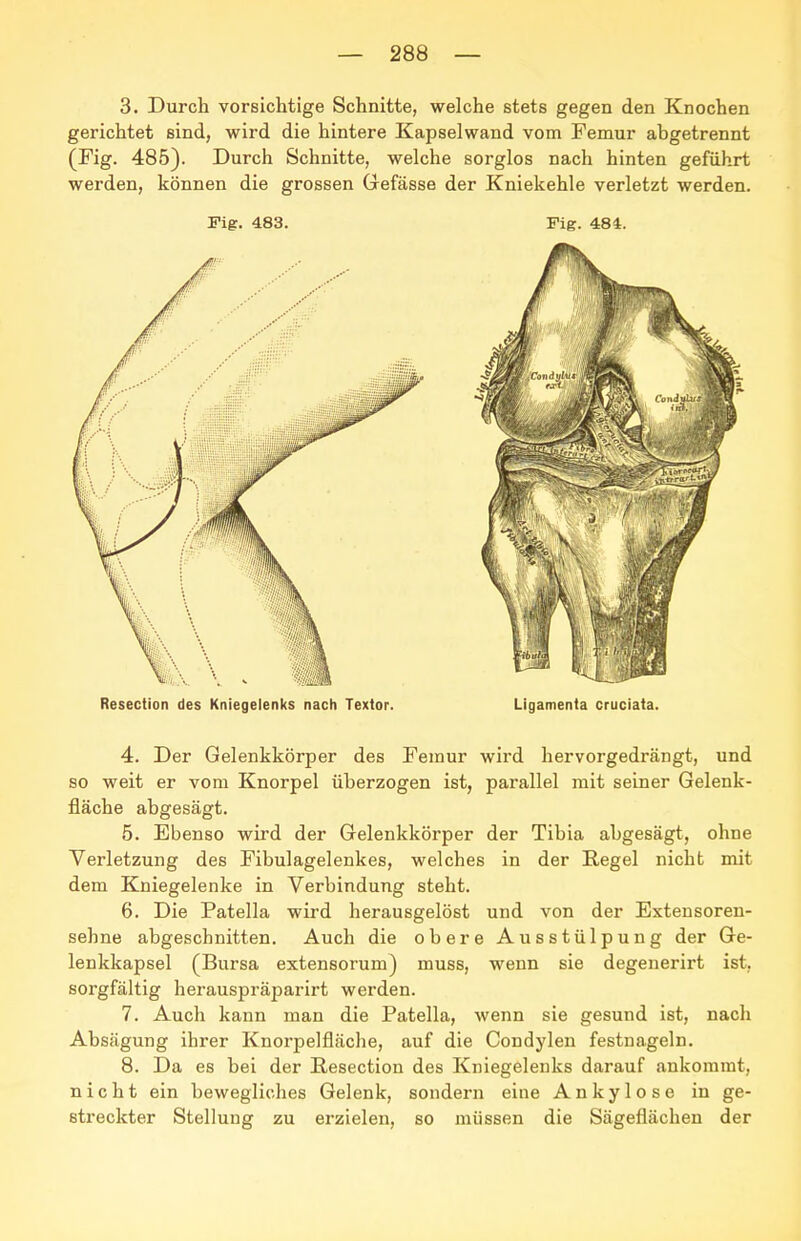 3. Durch vorsichtige Schnitte, welche stets gegen den Knochen gerichtet sind, wird die hintere Kapselwand vom Femur abgetrennt (Fig. 485). Durch Schnitte, welche sorglos nach hinten geführt werden, können die grossen Gefässe der Kniekehle verletzt werden. Fig. 483. Fig. 484. Resection des Kniegelenks nach Textor. Ligamenta cruciata. 4. Der Gelenkkörper des Femur wird hervorgedrängt, und so weit er vom Knorpel überzogen ist, parallel mit seiner Gelenk- fläche abgesägt. 6. Ebenso wird der Gelenkkörper der Tibia abgesägt, ohne Verletzung des Fibulagelenkes, welches in der Regel nicht mit dem Kniegelenke in Verbindung steht. 6. Die Patella wird herausgelöst und von der Extensoren- sehne abgeschnitten. Auch die obere Ausstülpung der Ge- lenkkapsel (Bursa extensorum) muss, wenn sie degenerirt ist, sorgfältig herauspräparirt werden. 7. Auch kann man die Patella, wenn sie gesund ist, nach Absägung ihrer Knorpelfläche, auf die Condylen festnageln. 8. Da es bei der ßesection des Kniegelenks darauf ankommt, nicht ein bewegliches Gelenk, sondern eine Ankylose in ge- streckter Stellung zu erzielen, so müssen die Sägeflächen der