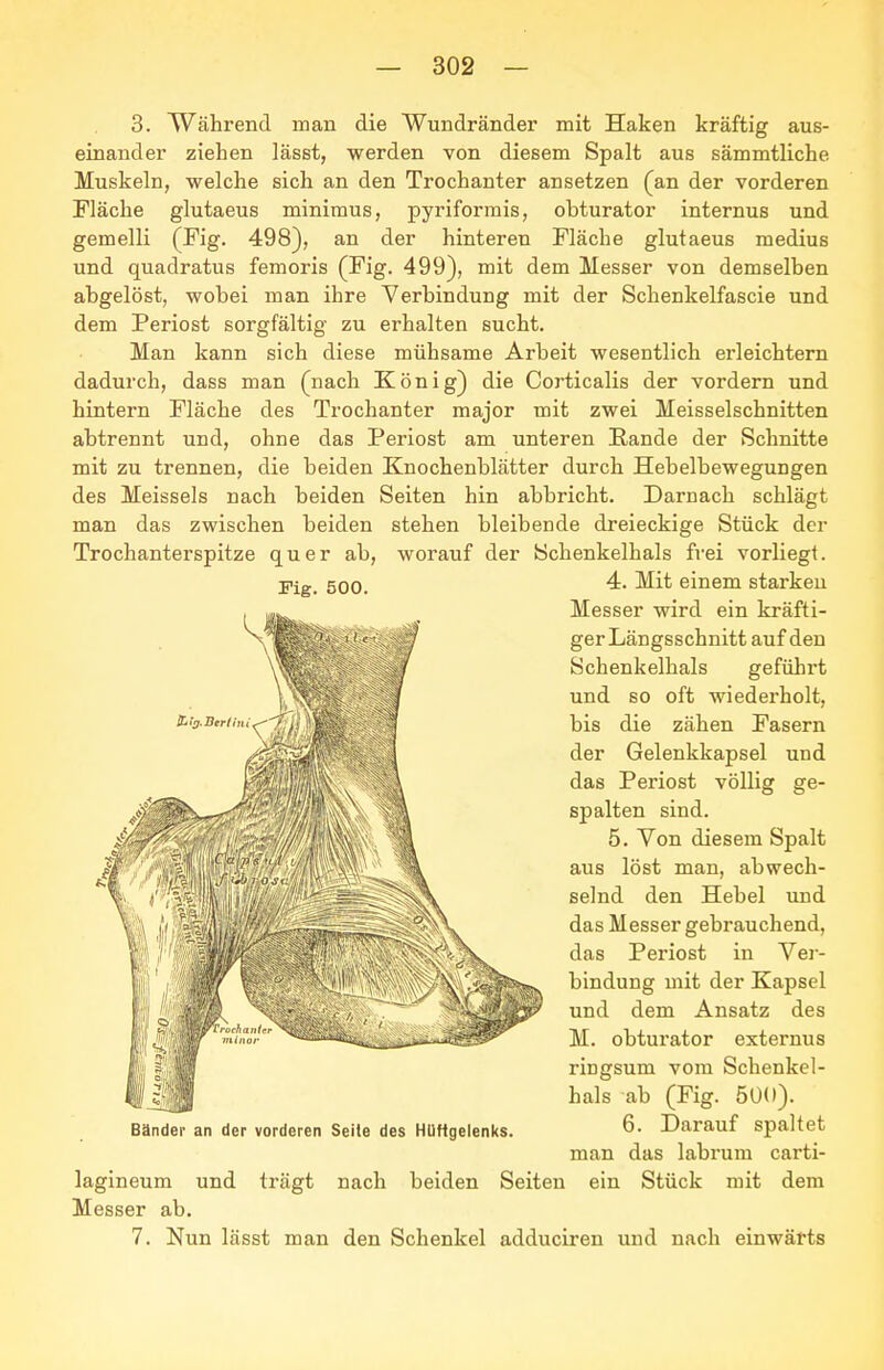 Fig. 500. 3. Während man die Wundränder mit Haken kräftig aus- einander ziehen lässt, werden von diesem Spalt aus sämmtliche Muskeln, welche sich an den Trochanter ansetzen (an der vorderen Fläche glutaeus minimus, pyriformis, obturator internus und gemein (Fig. 498), an der hinteren Fläche glutaeus medius und quadratus femoris (Fig. 499), mit dem Messer von demselben abgelöst, wobei man ihre Verbindung mit der Schenkelfascie und dem Periost sorgfältig zu erhalten sucht. Man kann sich diese mühsame Arbeit wesentlich erleichtern dadurch, dass man (nach König) die Corticalis der vordem und hintern Fläche des Trochanter major mit zwei Meisselschnitten abtrennt und, ohne das Periost am unteren Rande der Schnitte mit zu trennen, die beiden Knochenblätter durch Hebelbewegungen des Meisseis nach beiden Seiten hin abbricht. Darnach schlägt man das zwischen beiden stehen bleibende dreieckige Stück der Trochanterspitze quer ab, worauf der Schenkelhals frei vorliegt. 4. Mit einem starkeu Messer wird ein kräfti- ger Längsschnitt auf den Schenkelhals geführt und so oft wiederholt, bis die zähen Fasern der Gelenkkapsel und das Periost völlig ge- spalten sind. 5. Von diesem Spalt aus löst man, abwech- selnd den Hebel und das Messer gebrauchend, das Periost in Ver- bindung mit der Kapsel und dem Ansatz des M. obturator externus ringsum vom Schenkel- hals ab (Fig. 5Ü0). 6. Darauf spaltet man das labrum carti- lagineum und trägt nach beiden Seiten ein Stück mit dem Messer ab. 7. Nun lässt man den Schenkel adduciren und nach einwärts Bänder an der vorderen Seite des Hüftgelenks.