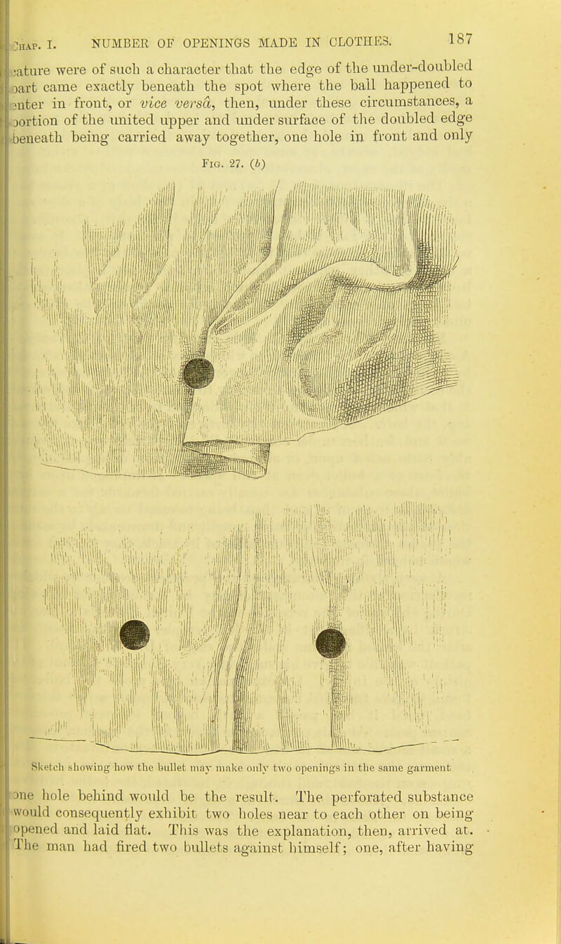 Mtiire were of sucb a character that the edge of the under-doubled larfc came exactly beneath the spot where the ball happened to ■liter in front, or vice versa, then, under these circumstances, a lortion of the imited upper and under surface of tlie doubled edge iieneath being carried away together, one hole in front and only Fig. 27. (i) Sketch showing how the bullet may make only two openings in the same garment :one hole behind would be the result. The perforated substance -would consequently exhibit, two holes near to each other on being opened and laid flat. This was the explanation, then, arrived at. iThe man had fii'ed two bullets against himself; one, after having