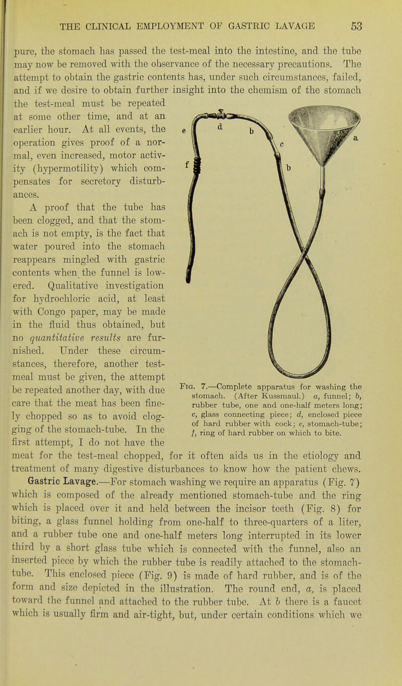 pure, the stomach has passed the test-meal into the intestine, and the tuho may now be removed with the observance of the necessary precautions. The attempt to obtain the gastric contents has, under such circumstances, failed, and if we desire to obtain further insight into the chemism of the stomach the test-meal must be repeated at some other time, and at an earlier hour. At all events, the operation gives proof of a nor- mal, even increased, motor activ- ity (hypermotility) which com- pensates for secretory disturb- ances. A proof that the tube has been clogged, and that the stom- ach is not empty, is the fact that water poured into the stomach reappears mingled with gastric contents when the funnel is low- ered. Qualitative investigation for hvdrochloric acid, at least with Congo paper, may be made in the fluid thus obtained, but no quantitative results are fur- nished. Under these circum- stances, therefore, another test- meal must be given, the attempt be repeated another day, with due care that the meat has been fine- ly chopped so as to avoid clog- ging of the stomach-tube. In the first attempt, I do not have the meat for the test-meal chopped, for it often aids us in the etiology and treatment of many digestive disturbances to know how the patient chews. Gastric Lavage.—For stomach washing we require an apparatus (Fig. 7) which is composed of the already mentioned stomach-tube and the ring which is placed over it and held between the incisor teeth (Fig. 8) for biting, a glass funnel holding from one-half to three-quarters of a liter, and a rubber tube one and one-half meters long interrupted in its lower third by a short glass tube which is connected with the funnel, also an inserted piece by which the rubber tube is readily attached to the stomach- tube. This enclosed piece (Fig. 9) is made of hard rubber, and is of the form and size depicted in the illustration. The round end, a, is placed toward the funnel and attached to the rubber tuhe. At h there is a faucet which is usually firm and air-tight, but, under certain conditions which we Fig. 7.—Complete apparatus for washing the stomach. (After Kussmaul.) a, funnel; h, rubber tube, one and one-half meters long; c, glass connecting piece; d, enclosed piece of hard rubber with cock; e, stomach-tube; /, ring of hard rubber on which to bite.