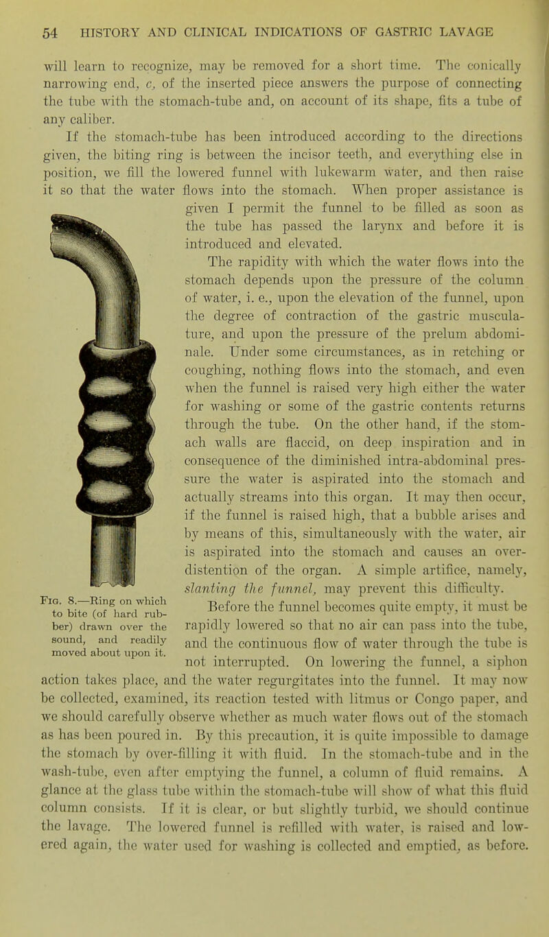 will learn to recognize, may be removed for a short time. The conically narrowing end, c, of the inserted piece answers the purpose of connecting the tube with the stomach-tube and, on account of its shape, fits a tube of any caliber. If the stomach-tube has been introduced according to the directions given, the biting ring is between the incisor teeth, and everything else in position, we fill the lowered funnel with lukewarm water, and then raise it so that the water flows into the stomach. When proper assistance is given I permit the funnel to be filled as soon as the tube has passed the larynx and before it is introduced and elevated. The rapidity with which the water flows into the stomach depends upon the pressure of the column of water, i. e., upon the elevation of the funnel, upon the degree of contraction of the gastric muscula- ture, and upon the pressure of the prelum abdomi- nale. Under some circumstances, as in retching or coughing, nothing flows into the stomach, and even when the funnel is raised very high either the water for washing or some of the gastric contents returns through the tube. On the other hand, if the stom- ach walls are flaccid, on deep inspiration and in consequence of the diminished intra-abdominal pres- sure the water is aspirated into the stomach and actually streams into this organ. It may then occur, if the funnel is raised high, that a bubble arises and by means of this, simultaneously with the water, air is aspirated into the stomach and causes an over- distention of the organ. A simple artifice, namely, slanting the funnel, may prevent this difficulty. Before the funnel becomes quite empty, it must be rapidly loM^ered so that no air can pass into the tube, and the continuoiis flow of water through the ti;be is not interrupted. On lowering the funnel, a siphon action takes place, and the water regurgitates into the funnel. It may now be collected, examined, its reaction tested with litmus or Congo paper, and we should carefully observe whether as much water flows out of the stomach as has been poured in. By this precaution, it is quite impossible to damage the stomach by over-filling it with fluid. In the stomach-tube and in the wash-tube, even after emptying the funnel, a column of fluid remains. A glance at the glass tube within the stomach-tube will show of what this fluid column consists. If it is clear, or but slightly turbid, we should continue the lavage. The lowered funnel is refilled with water, is raised and low- ered again, the water used for washing is collected and emptied, as before. Fig. 8.—Ring on which to bite (of hard rub- ber) drawn over the sound, and readily moved about upon it.