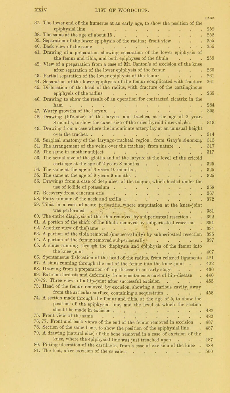 37. The lower end of the humerus at an early age, to show the position of the epiph)'sial line 252 38. The same at the age of about 15 252 39. Separation of the lower epiphysis of the radius; front view . . . 255 40. Back view of the same 255 41. Drawing of a preparation showing separation of the lower epiphysis of the femur and tibia, and both epiphyses of the fibula . . . 259 42. View of a preparation from a case of Mr. Canton's of excision of the knee after separation of the lower epiphysis of the femur . . . 260 43. Partial separation of the lower epiphysis of the femur .... 261 44. Separation of the lower epiphysis of the femur complicated with fracture 261 45. Dislocation of the head of the radius, with fracture of the cartilaginous epiphysis of the radius 265 46. Drawing to show the result of an operation for contracted cicatrix in the ham 284 47. Warty growths of the larynx 305 48. Drawing (life-size) of the larynx and trachea, at the age of 2 years 8 months, to show the exact size of the cricothyroid interval, Ac. . 313 49. Drawing from a case where the innominate artery lay at an unusual height over the trachea 314 50. Surgical anatomy of the laryngo-tracheal region; from Gray's Anatomy 315 51. The arrangement of the veins over the trachea; from nature . . , 317 52. The same in another subject 317 53. The actual size of the glottis and of the larynx at the level of the cricoid cartilage at the age of 2 years 8 months 325 54. The same at the age of 3 years 10 months 325 55. The same at the age of 9 years 9 months 325 56. Drawings from a case of deep ulcer of the tongue, which healed under the use of iodide of potassium 358 57. Recovery from cancrum oris 367 58. Fatty tumour of the neck and axilla 372 59. Tibia in a case of acute periostitis,,where amputation at the knee-joint was performed .. r; ' .' . ■■ 381 60. The entire diaphysis of the tibia remoyed by subperiosteal resection . . 392 61. A portion of the shaft of the fibula removed by subperiosteal resection . 394 62. Another view of thel^same .• . . . V 394 63. A portion of the tibia removed (imsuccessf uUy) by subperiosteal resection 395 64. A portion of the femur removed subperiosteally■ 397 65. A sinus running through the diaphysis and efiiphysis of the femur mto the knee-joint 407 66. Spontaneous dislocation of the head of the radius, fr6m relaxed ligaments 421 67. A smus running through the end of the femur mto the knee-jomt . . 422 68. Drawing from a preparation of hip-disease in an early stage . . . 436 69. Extreme lordosis and deformity from spontaneous cure of hip-disease . 440 70-72. Three views of a hip-joint after successful excision .... 455 73. Head of the femur removed by excision, showmg a carious cavity, away from the articular surface, contaming a sequestrum .... 458 74, A section made through the femur and tibia, at the age of 5, to show the position of the epiphysial line, and the level at which the section should be made in excision 482 75. Front view of the same 482 76, 77. Front and back views of the end of the femur removed in excision . 487 78. Section of the same bone, to show the position of the epiphysial line . 487 79. A drawing (natural size) of the bone removed in a case of excision of the kjiee, where the epiphysial line was just trenched upon . . . 487 80. Pitting ulceration of the cartilages, from a case of excision of the knee . 488 81. The foot, after excision of the os calcis 500