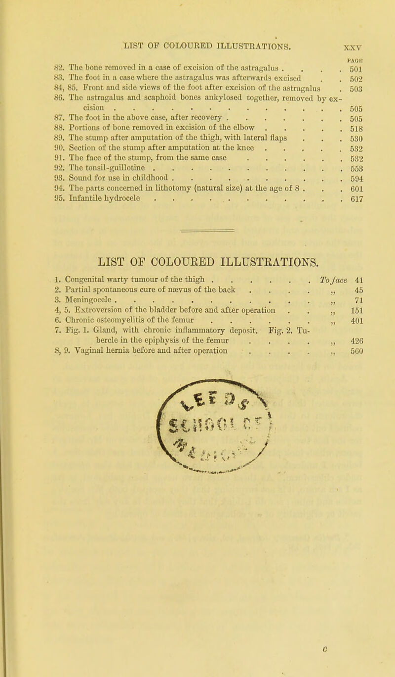 PA UK 82. The bone removed in a case of excision of the astragalus .... 501 83. The foot in a case where the astragahis was afterwards excised . . 502 84. 85. Front and side views of the foot after excision of the astragalus . 503 86. The astragalus and scaphoid bones ankylosed together, removed by ex- cision 506 87. The foot in the above case, after recovery 505 88. Portions of bone removed in excision of the elbow 518 89. The stump after amputation of the thigh, with lateral flaps . . . 580 90. Section of the stump after amputation at the knee 532 91. The face of the stump, from the same case 632 92. The tonsil-guillotine 553 93. Soimd for use in childhood 594 94. The parts concerned in lithotomy (natural size) at the age of 8 . . . 601 95. Infantile hydrocele 617 LIST OF COLOURED ILLUSTRATIONS. 1. Congenital warty timiour of the thigh Tojace 41 2. Partial spontaneous cure of uktos of the back .... „ 45 3. Meningocele „ 71 4. 5. Extroversion of the bladder before and after operation . . ,, 151 6. Chronic osteomyelitis of the femur „ 401 7. Fig. 1. Gland, with chronic inflammatory deposit. Fig. 2. Tu- bercle in the epiphysis of the femur . . . . ,, 426 8,9. Vaginal hernia before and after operation . . . . 5G0 G