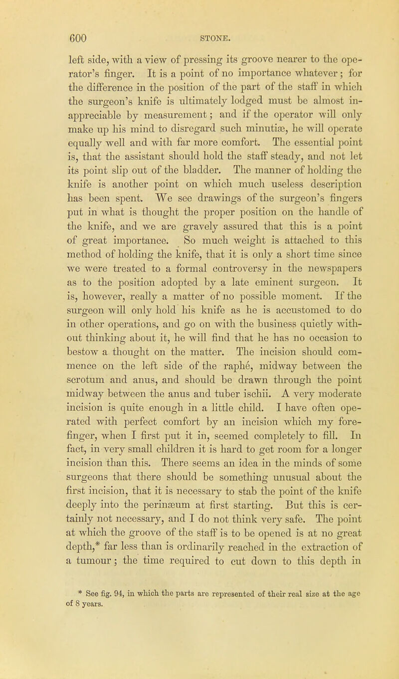 left side, with a view of pressing its groove nearer to the ope- rator's finger. It is a point of no importance whatever ; for the difference in the position of the part of the staff in which the siu'geon's knife is ultimately lodged must be almost in- appreciable by measurement; and if the operator will only make up his mind to disregard such minutias, he will operate equally well and with far more comfort. The essential point is, that the assistant should hold the staff steady, and not let its point slip out of the bladder. The manner of holding the knife is another point on which much useless description has been spent. We see drawings of the surgeon's fingers put in what is thought the proper position on the handle of the knife, and we are gravely assured that this is a point of great importance. So much weight is attached to this method of holding the knife, that it is only a short time since we were treated to a formal controversy in the newspapers as to the position adopted by a late eminent surgeon. It is, however, really a matter of no possible moment. If the surgeon will only hold his knife as he is accustomed to do in other operations, and go on with the business quietly with- out thinking about it, he will find that he has no occasion to bestow a thought on the matter. The incision should com- mence on the left side of the raphe, midway between the scrotum and anus, and should be drawn tlu'ough the point midway between the anus and tuber ischii. A very moderate incision is quite enough in a little child. I have often ope- rated with perfect comfort by an incision which my fore- finger, when I first put it in, seemed completely to fill. In fact, in very small children it is hai'd to get room for a longer incision than this. There seems an idea in the minds of some surgeons that there should be something unusual about the first incision, that it is necessaiy to stab the point of the knife deeply into the perinaaum at first starting. But this is cei'- tainly not necessaiy, and I do not think very safe. The point at which the groove of the staff is to be opened is at no great depth,* far less than is ordinarily reached in the extraction of a tumour; the time required to cut down to this deptli in * See fig. 94, in which the parts are represented of their real size at the age of 8 years.