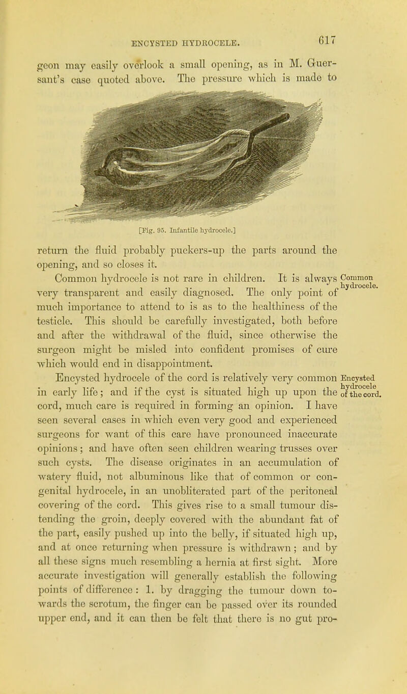 ENCYSTED HYDROCELE. geon may easily overlook a small opening, as in M. Guer- sant's case quoted above. Tlie pressm-e wliich is made to [Fig. 95. InfantUe hydrocele.] return the fluid probably puckers-up tlie parts around the opening, and so closes it. Common hydrocele is not rare in children. It is always Common very transparent and easily diagnosed. The only point of much importance to attend to is as to the healthiness of the testicle. This should be carefully investigated, both before and after the withdrawal of the fluid, since otherwise the surgeon might be misled into confident promises of cm'e which would end in disappointment. Encysted hydrocele of the cord is relatively very common Encysted in early life; and if the cyst is situated high up upon the of^eccJrd. cord, much care is required in forming an opinion. I have seen several cases in which even very good and experienced surgeons for want of this care have pronounced inaccurate opinions; and have often seen children wearing trusses over such cysts. The disease originates in an accumulation of watery fluid, not albuminous like that of common or con- genital hydrocele, in an unobliterated part of the peritoneal covering of the cord. This gives rise to a small tumour dis- tending the groin, deeply covered with the abundant fat of the part, easily pushed up into the belly, if situated high up, and at once returning when pressure is withdrawn; and by all these signs much resembling a hernia at first sight. More accurate investigation will generally establish the following points of difference : 1. by dragging the tumom' down to- wards the scrotum, the finger can be passed over its rounded upper end, and it can then be felt that there is no gut pro-