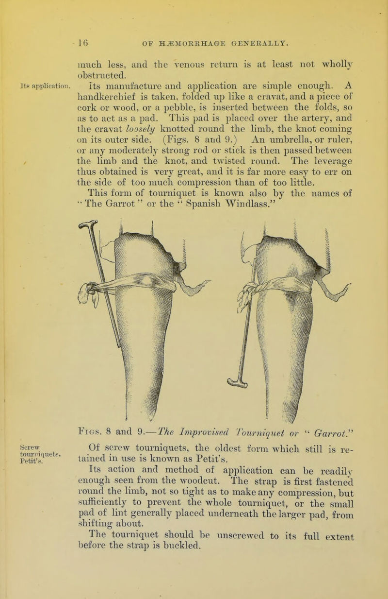 much less, and the venous return is at least not wholly obstructed. [to application. Its manufacture and application are simple enough. A handkerchief is taken, folded up like a cravat, and a piece of cork or wood, or a pebble, is inserted between the folds, so as to act as a pad. This pad is placed over the artery, and the cravat loosely knotted round the limb, the knot coming on its outer side. (Figs. 8 and 9.) An umbrella, or ruler, or any moderately strong rod or stick is then passed between the limb and the knot, and twisted round. The leverage thus obtained is very great, and it is far more easy to err on the side of too much compression than of too little. This form of tourniquet is known also by the names of '• The Garrot  or the  Spanish Windlass. Screw Of screw tourniquets, the oldest form which still is re- i-vtit's. lamed in use is known as Petit s. Its action and method of application can be readily enough seen from the woodcut. The strap is first fastened round the limb, not so tight as to make any compression, but sufficiently to prevent the whole tourniquet, or the small pad of lint generally placed underneath the larger pad, from shifting about. The tourniquet should be unscrewed to its full extent before the strap is buckled.