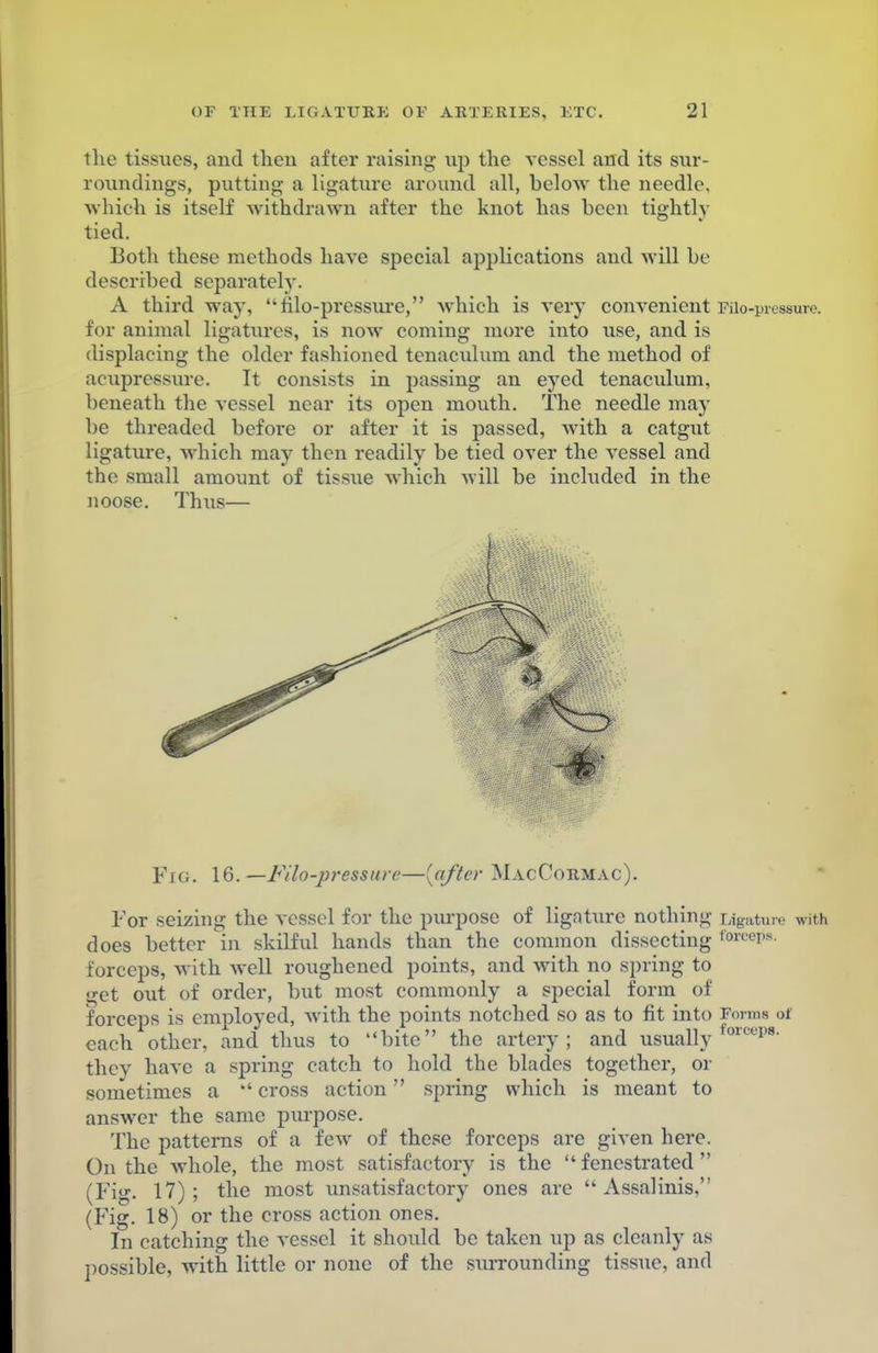 the tissues, and then after raising- up the vessel and its sur- roundings, putting a ligature around all, below the needle, which is itself withdrawn after the knot has been tightly tied. Both these methods have special applications and will be described scparateljr. A third way, filo-pressure, which is very convenient Filo-pressure. for animal ligatures, is now coming more into use, and is displacing the older fashioned tenaculum and the method of acupressure. It consists in passing an eyed tenaculum, beneath the vessel near its open mouth. The needle may be threaded before or after it is passed, with a catgut ligature, which may then readily be tied over the vessel and the small amount of tissue which will be included in the noose. Thus— Fig. 16.— Filo-pressure—{after MacCormac). For seizing the vessel for the purpose of ligature nothing rjgatere with does better in skilful hands than the common dissecting fowwps- forceps, with well roughened points, and with no spring to get out of order, but most commonly a special form of forceps is employed, with the points notched so as to fit into Forms of each other, and thus to bite the artery; and usually orceps' they have a spring catch to hold the blades together, or sometimes a  cross action spring which is meant to answer the same purpose. The patterns of a few of these forceps are given here. On the whole, the most satisfactory is the fenestrated (Fig. 17); the most unsatisfactory ones are Assalinis, (Fig. 18) or the cross action ones. In catching the vessel it should be taken up as cleanly as possible, with little or none of the surrounding tissue, and