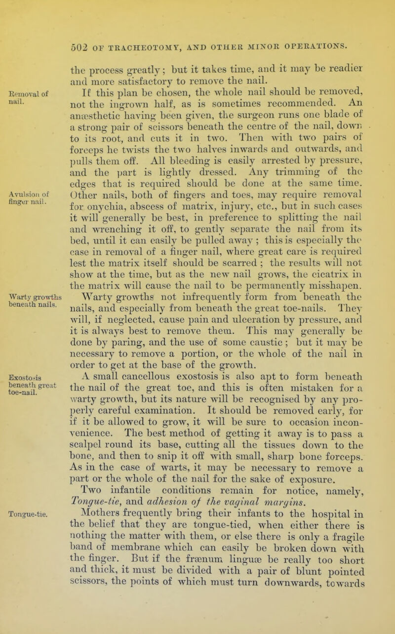 Removal of nail. Avulsion of finger nail. Warty growths beneath nails. Exostosis beneath great toe-nail. Ton?ue-tie. the process greatly; but it takes time, and it may be readier and more satisfactory to remove the nail. If this plan be chosen, the whole nail should be removed, not the ingrown half, as is sometimes recommended. An anaesthetic having been given, the surgeon runs one blade of a strong pair of scissors beneath the centre of the nail, down to its root, and cuts it in two. Then with two pairs of forceps he twists the two halves inwards and outwards, and pulls them off. All bleeding is easily arrested by pressure, and the part is lightly dressed. Any trimming of the edges that is required should be done at the same time. Other nails, both of fingers and tin s, may require removal for onychia, abscess of matrix, injury, etc., but in such cases it will generally be best, in preference to splitting the nail and wrenching it off, to gently separate the nail from its bed, until it can easily be pulled away ; this is especially the case in removal of a finger nail, where great care is required lest the matrix itself should be scarred ; the results will not show at the time, but as the new nail grows, the cicatrix in the matrix will cause the nail to be permanently misshapen. Warty growths not infrequently form from beneath the nails, and especially from beneath the great toe-nails. They will, if neglected, cause pain and ulceration by pressure, and it is always best to remove them. This may generally be done by paring, and the use of some caustic ; but it may be necessary to remove a portion, or the whole of the nail in order to get at the base of the growth. A small cancellous exostosis is also apt to form beneath the nail of the great toe, and this is often mistaken for a warty growth, but its nature will be recognised by any pro- perly careful examination. It should be removed early, for if it be allowed to grow, it will be sure to occasion incon- venience. The best method of getting it away is to pass a scalpel round its base, cutting all the tissues dowm to the bone, and then to snip it off with small, sharp bone forceps. As in the case of warts, it may be necessary to remove a part or the whole of the nail for the sake of exposure. Two infantile conditions remain for notice, namely, Tongue-tie, and adhesion of the vaginal margins. Mothers frequently bring their infants to the hospital in the belief that they are tongue-tied, when either there is nothing the matter with them, or else there is only a fragile band of membrane which can easily be broken down with the finger. But if the frsenum lingua? be really too short and thick, it must be divided with a pair of blunt pointed scissors, the points of which must turn downwards, towards