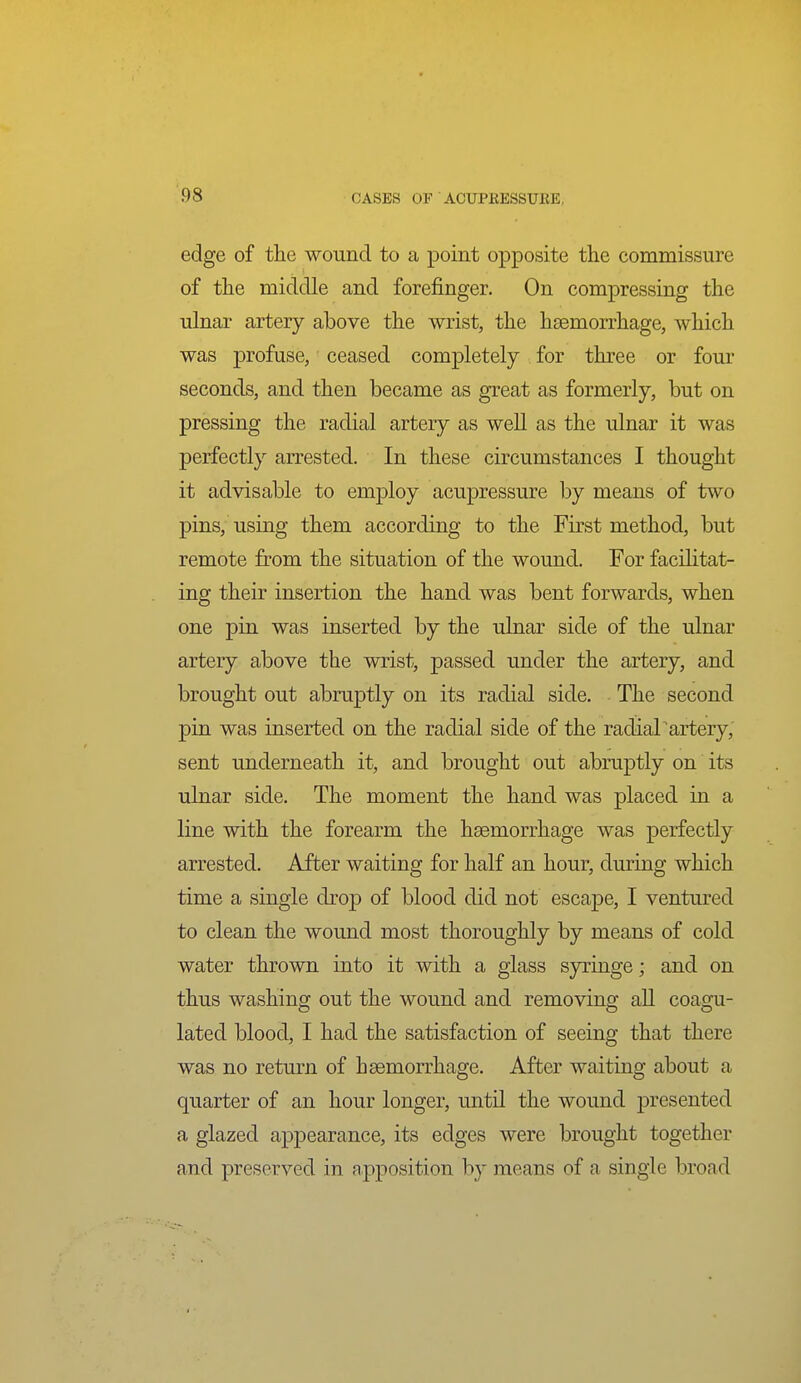 edge of tlie wound to a point opposite the commissure of tlie middle and forefinger. On compressing the ulnar artery above the wrist, the haemorrhage, which was profuse, ceased completely for three or four seconds, and then became as great as formerly, but on pressing the radial artery as well as the ulnar it was perfectly arrested. In these circumstances I thought it advisable to employ acupressure by means of two pins, using them according to the First method, but remote from the situation of the wound. For facilitat- ing their insertion the hand was bent forwards, when one pin was inserted by the ulnar side of the ulnar artery above the wrist, passed under the artery, and brought out abruptly on its radial side. The second pin was inserted on the radial side of the radiarartery, sent underneath it, and brought out abruptly on its ulnar side. The moment the hand was placed in a line with the forearm the haemorrhage was perfectly arrested. After waiting for half an hour, during which time a single drop of blood did not escape, I ventm^ed to clean the wound most thoroughly by means of cold water thrown into it with a glass sjringe; and on thus washing out the wound and removing all coagu- lated blood, I had the satisfaction of seeing that there was no retm-n of haemorrhage. After waiting about a quarter of an hour longer, untU the wound presented a glazed appearance, its edges were brought together and preserved in apj^osition by means of a single broad