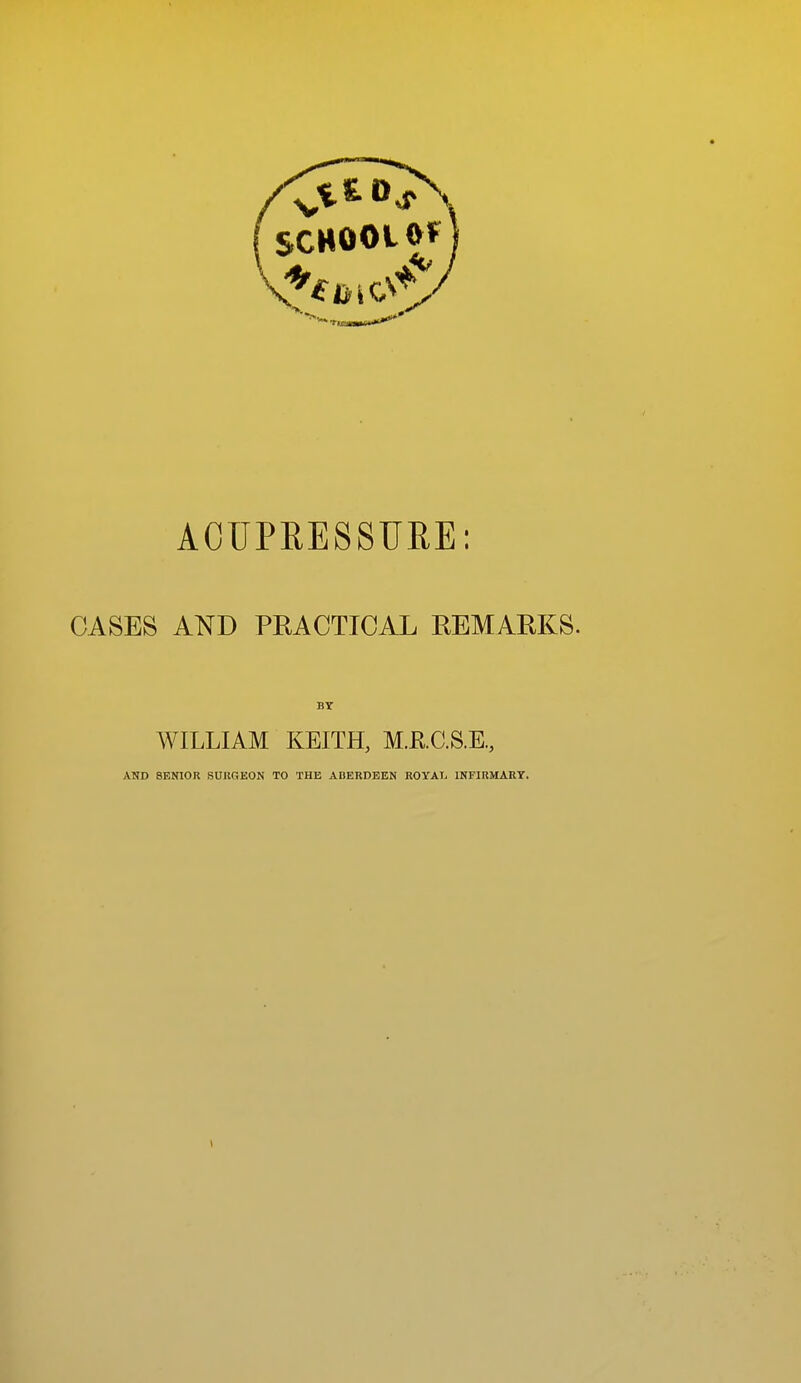 fSCHOOL»F A0UPKE8SURE; CASES AND PRACTICAL REMARKS. WILLIAM KEITH, M.RC.S.E., AND SENIOR SUUGEON TO THE ABERDEEN ROYATi INFIRMARY.
