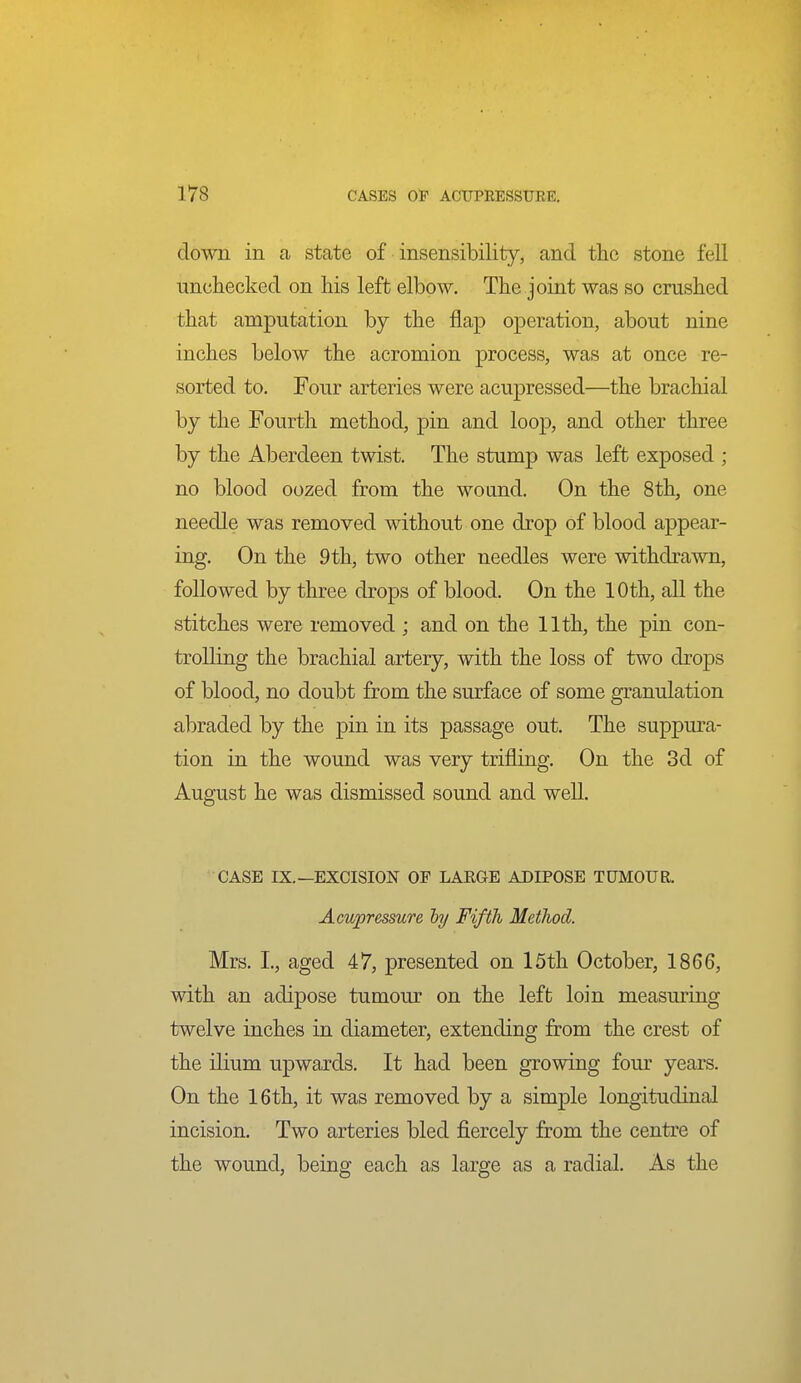 down in a state of insensibility, and the stone fell unchecked on liis left elbow. The joint was so crushed that amputation by the flap operation, about nine inches below the acromion process, was at once re- sorted to. Four arteries were acupressed—the brachial by the Fourth method, pin and loop, and other three by the Aberdeen twist. The stump was left exposed ; no blood oozed from the wound. On the 8th, one needle was removed without one drop of blood appear- ing. On the 9th, two other needles were withdrawn, followed by three drops of blood. On the 10th, all the stitches were removed ; and on the 11th, the pin con- trolling the brachial artery, with the loss of two drops of blood, no doubt from the surface of some granulation abraded by the pin in its passage out. The suppura- tion in the wound was very trifling. On the 3d of August he was dismissed sound and well. CASE IX.—EXCISION OF LAEGE ADIPOSE TUMOUR. Acupressure hj Fifth Method. Mrs. I., aged 47, presented on 15th October, 1866, with an adipose tumour on the left loin measuring twelve inches in diameter, extending from the crest of the ilium upwards. It had been growing four years. On the 16th, it was removed by a simple longitudinal incision. Two arteries bled fiercely from the centre of the wound, being each as large as a radial. As the