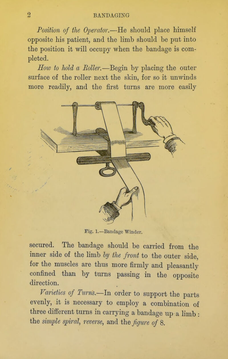 Position of the Operator.—He should place himself opposite his patient, and the limb should be put into the position it will occupy when the bandage is com- pleted. How to hold a Roller.—Begin by placing the outer surface of the roller next the skin, for so it unwinds more readily, and the first turns are more easily Eig. 1.—Bandage Winder. secured. The bandage should be carried from the inner side of the limb by the front to the outer side, for the muscles are thus more firmly and pleasantly confined than by turns passing in the opposite direction. Varieties of Turns.—In order to support the parts evenly, it is necessary to employ a combination of three different turns in carrying a bandage up a limb : the simple spiral, reverse, and the figure of 8.