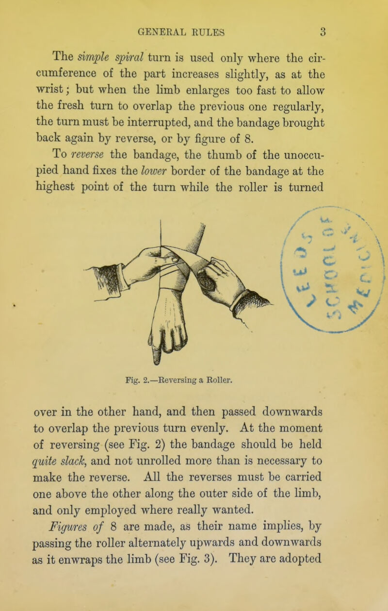 The simple spiral turn is used only where the cir- cumference of the part increases slightly, as at the wrist; but when the limb enlarges too fast to alloAv the fresh turn to overlap the previous one regularly, the turn must be interrupted, and the bandage brought back again by reverse, or by figure of 8. To reverse the bandage, the thumb of the unoccu- pied hand fixes the loioer border of the bandage at the highest point of the turn while the roller is turned Fig. 2.—Keversing a Roller. over in the other hand, and then passed downwards to overlap the previous turn evenly. At the moment of reversing (see Fig. 2) the bandage should be held quite slack, and not unrolled more than is necessary to make the reverse. All the reverses must be carried one above the other along the outer side of the limb, and only employed where really wanted. Figures of 8 are made, as their name implies, by passing the roller alternately upwards and downwards as it enwraps the limb (see Fig. 3). They are adopted