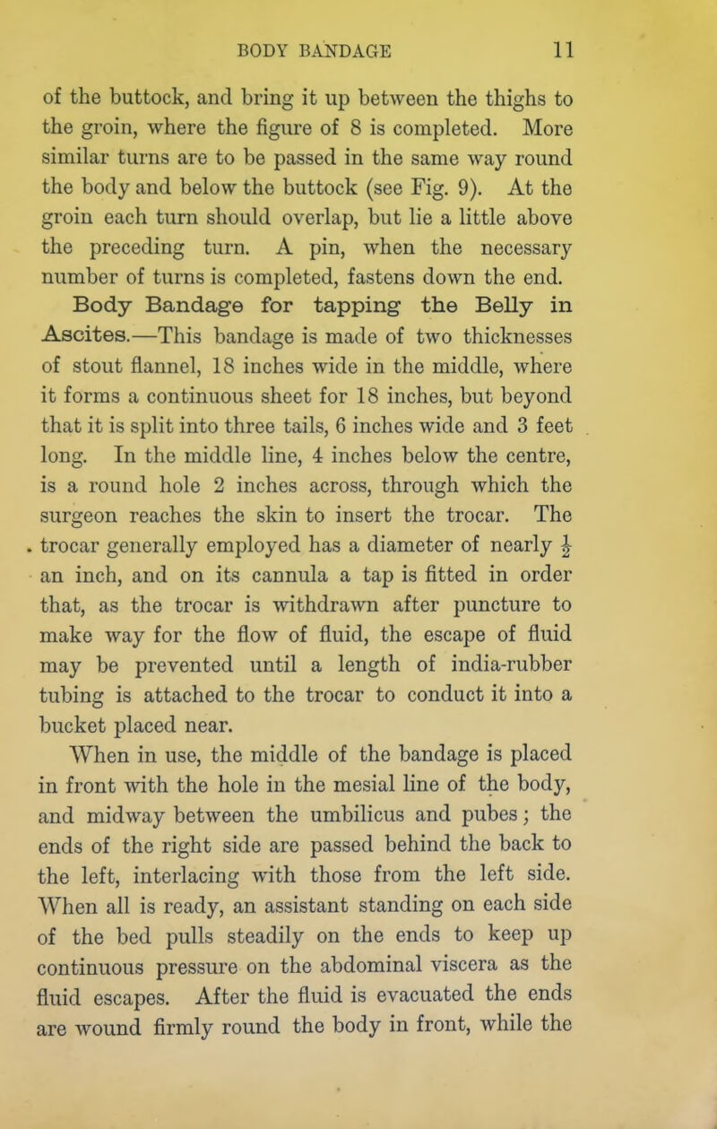 of the buttock, and bring it up between the thighs to the groin, where the figure of 8 is completed. More similar turns are to be passed in the same way round the body and below the buttock (see Fig. 9). At the groin each turn should overlap, but lie a little above the preceding turn. A pin, when the necessary number of turns is completed, fastens down the end. Body Bandage for tapping the Belly in Ascites.—This bandage is made of two thicknesses of stout flannel, 18 inches wide in the middle, where it forms a continuous sheet for 18 inches, but beyond that it is split into three tails, 6 inches wide and 3 feet long. In the middle line, 4 inches below the centre, is a round hole 2 inches across, through which the surgeon reaches the skin to insert the trocar. The . trocar generally employed has a diameter of nearly ^ an inch, and on its cannula a tap is fitted in order that, as the trocar is withdrawn after puncture to make way for the flow of fluid, the escape of fluid may be prevented until a length of india-rubber tubing is attached to the trocar to conduct it into a bucket placed near. When in use, the middle of the bandage is placed in front with the hole in the mesial Hne of the body, and midway between the umbilicus and pubes; the ends of the right side are passed behind the back to the left, interlacing with those from the left side. When all is ready, an assistant standing on each side of the bed pulls steadily on the ends to keep up continuous pressure on the abdominal viscera as the fluid escapes. After the fluid is evacuated the ends are wound firmly round the body in front, while the