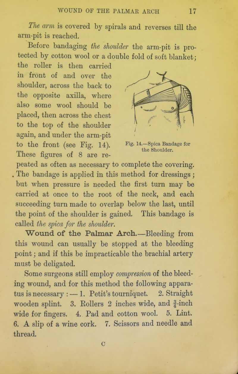 The arm is covered by spirals and reverses till the arm-pit is reached. Before bandaging the shoulder the arm-pit is pro- tected by cotton wool or a double fold of soft blanket; the roller is then carried in front of and over the shoulder, across the back to the opposite axilla, where also some wool should be placed, then across the chest to the top of the shoulder again, and under the arm-pit to the front (see Fis:, 14). Fig. 14.-Spica Bandage for X o the Shoulder. ihese ngures of 8 are re- peated as often as necessary to complete the covering. . The bandage is applied in this method for dressings ; but when pressure is needed the first turn may be carried at once to the root of the neck, and each succeeding turn made to overlap below the last, until the point of the shoulder is gained. This bandage is called the spica for the shoulder. Wound of the Palmar Arch.—Bleeding from this wound can usually be stopped at the bleeding point; and if this be impracticable the brachial artery must be deligated. Some surgeons still employ compression of the bleed- ing wound, and for this method the following appara- tus is necessary : — 1. Petit's tourniquet. 2. Straight wooden splint. 3. Rollers 2 inches wide, and |-inch wide for fingers. 4. Pad and cotton wool. 5. Lint. 6. A slip of a wine cork. 7. Scissors and needle and thread. C