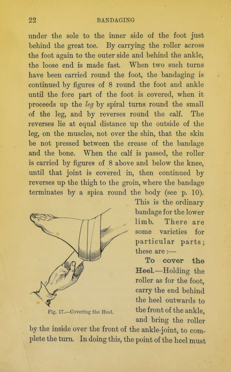 under the sole to the inner side of the foot just behind the great toe. By carrying the roller across the foot again to the outer side and behind the ankle, the loose end is made fast. When two such turns have been carried round the foot, the bandaging is continued by figures of 8 round the foot and ankle until the fore part of the foot is covered, when it proceeds up the leg by spiral turns round the small of the leg, and by reverses round the calf. The reverses lie at equal distance up the outside of the leg, on the muscles, not over the shin, that the skin be not pressed between the crease of the bandage and the bone. When the calf is passed, the roller is carried by figures of 8 above and below the knee, until that joint is covered in, then continued by reverses up the thigh to the groin, where the bandage terminates by a spica round the body (see p. 10). This is the ordina,ry bandage for the lower limb. There are some varieties for particular parts; these are:— To cover the Heel.—Holding the roller as for the foot, carry the end behind the heel outwards to Fig. 17.-Covering the Heel. '^^6 front of the ankle, and bring the roller by the inside over the front of the ankle-joint, to com- plete the turn. In doing this, the point of the heel must