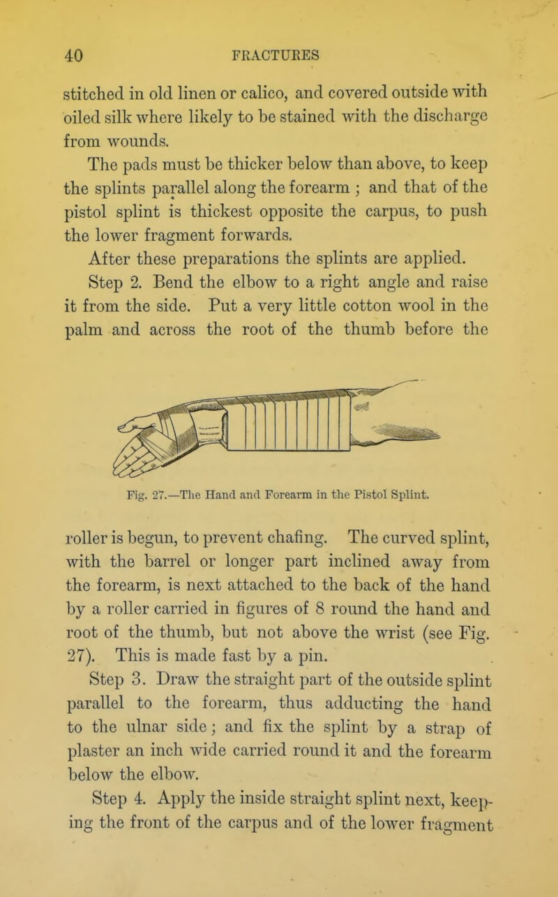 stitched in old linen or calico, and covered outside with oiled silk where likely to be stained with the discharge from wounds. The pads must be thicker below than above, to keep the splints parallel along the forearm ; and that of the pistol splint is thickest opposite the carpus, to push the lower fragment forwards. After these preparations the splints are applied. Step 2. Bend the elbow to a right angle and raise it from the side. Put a very little cotton wool in the palm and across the root of the thumb before the roller is begun, to prevent chafing. The curved splint, with the barrel or longer part inclined away from the forearm, is next attached to the back of the hand by a roller carried in figures of 8 round the hand and root of the thumb, but not above the wrist (see Fig. 27). This is made fast by a pin. Step 3. Draw the straight part of the outside splint parallel to the forearm, thus adducting the hand to the ulnar side; and fix the splint by a strap of plaster an inch wide carried round it and the forearm below the elbow. Step 4. Apply the inside straight splint next, keep- ing the front of the carpus and of the lower fragment