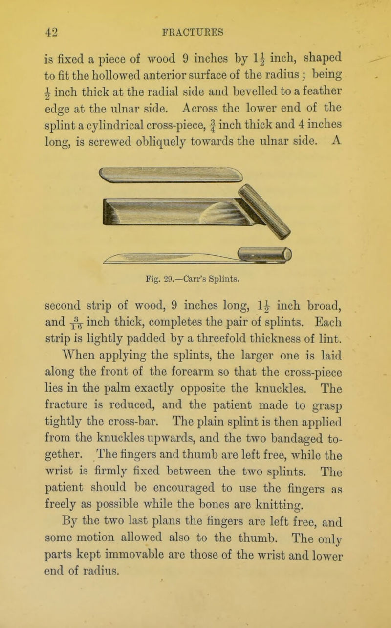 is fixed a piece of wood 9 inches by 1| inch, shaped to fit the hollowed anterior surface of the radius; being I inch thick at the radial side and bevelled to a feather edge at the ulnar side. Across the lower end of the splint a cylindrical cross-piece, f inch thick and 4 inches long, is screwed obliquely towards the ulnar side. A Fig. 29.—Carr's Splints. second strip of wood, 9 inches long, H inch broad, and -^^ inch thick, completes the pair of splints. Each strip is lightly padded by a threefold thickness of lint. When applying the splints, the larger one is laid along the front of the forearm so that the cross-piece lies in the palm exactly opposite the knuckles. The fracture is reduced, and the patient made to grasp tightly the cross-bar. The plain splint is then applied from the knuckles upwards, and the two bandaged to- gether. The fingers and thumb are left free, while the wrist is firmly fixed between the two splints. The patient should be encouraged to use the fingers as freely as possible while the bones are knitting. By the two last plans the fingers are left free, and some motion allowed also to the thumb. The only parts kept immovable are those of the wrist and lower end of radius.