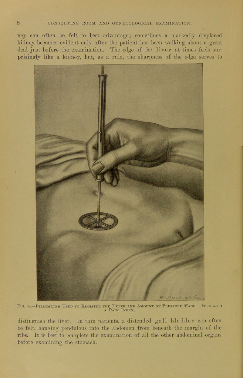 ney can often be felt to best advantage; sometimes a markedly displaced kidney becomes evident only after the patient has been walking about a great deal just before the examination. The edge of the liver at times feels sur- prisingly like a kidney, but, as a rule, the sharpness of tlic edge serves to Fifi. 4.—Piezometer Used to Register the Ukpth and Amount of Pressure Made. It is also A Pain Index. distinguish the liver. In thin patients, a distended gall bladder can often be felt, banging pendulous into the abdomen from beneath the margin of the ribs. It is best to complete the examination of all the other abdominal organs before examining the stomach.