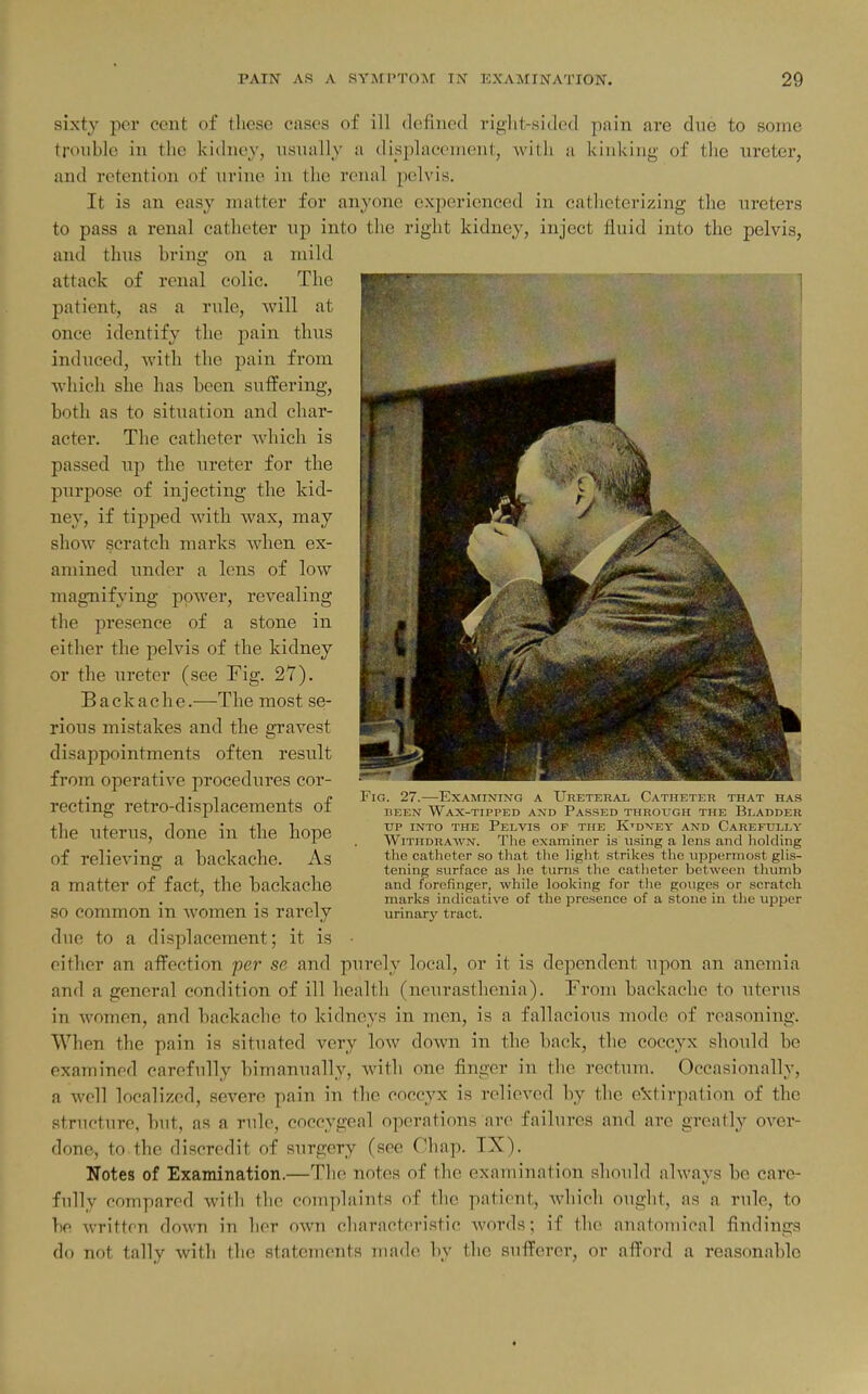 sixty per cent of these cases of ill defined right-sided pain are duo to some trouble in the kidney, usually a displacement, with a kinking of the ureter, and retention of xirine in the renal pelvis. It is an easy matter for anyone experienced in catlieterizing the ureters to pass a renal catheter up into the right kidney, inject fluid into the pelvis, and thus bring on a mild attack of renal colic. The patient, as a rule, will at once identify the pain thus induced, with the pain from which she has been suffering, both as to situation and char- acter. The catheter which is passed up the ureter for the purpose of injecting the kid- ney, if tipped with wax, may show scratch marks when ex- amined under a lens of low magnifying power, revealing the presence of a stone in either the pelvis of the kidney or the ureter (see Fig. 27). Backache.—The most se;- rious mistakes and the gravest disappointments often result from operative procedures cor- recting retro-displacements of the uterus, done in the hope of relieving a backache. As a matter of fact, the backache so common in women is rarely due to a displacement; it is either an affection per se and purely local, or it is dependent upon an anemia and a general condition of ill health (neurasthenia). From backache to uterus in women, and backache to kidneys in men, is a fallacious mode of reasoning. When the pain is situated very low down in the back, the coccyx should be examined carefully bimanually, with one finger in tlie rectum. Occasionally, a well localized, severe pain in the coccyx is relieved by the extirpation of the structure, but, as a rule, coccygeal operations are failures and are greatly over- done, to the discredit of surgery (see Chap. IX). Notes of Examination.—The notes of the examination should always be care- fully compared with the complaints of the patient, whicli ought, as a rule, to be written down in lier own characteristic Avords; if the anatomical findings do not tally with the statements made by the suflFerer, or afford a reasonable Fig. 27.—Examining a Ureteral, Catheter that has BEEN Wax-tipped and Passed through the Bladder UP into the Pelvis of the Kidney and Carefully Withdrawn. The examiner is using a lens and holding the catheter so that the light strilces the uppermost glis- tening surface as he turns the catheter between thumb and forefinger, while looking for the gouges or scratch marks indicative of the presence of a stone in the upper urinary tract.