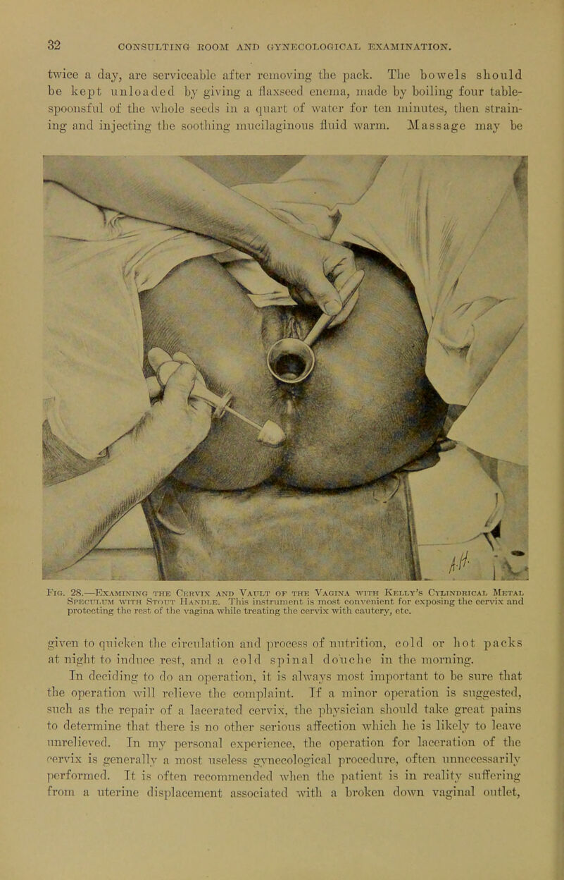 twice a day, are serviceable after removing the pack. The bowels should be kept unloaded by giving a flaxseed eneina, made by boiling four table- spoonsful of the whole seeds in a quart of water for ten minutes, then strain- ing and injecting the soothing mucilaginous fluid warm. Massage may be Fig. 28.—Examining the Cervix and Vault of the Vagina with Kelly's Oixindrical Metal Speculum with Stout Handle. 'I'liis instriitnent is ino.st. convoniont for exposing tlic cervix aud protecting the rest of the vagina while treating tlic cervix with cautery, etc. given to quicken the circulation and process of nutrition, cold or hot packs at night to induce rest, and a cold spinal douche in the morning. In deciding to do an operation, it is always most important to be sure that the operation Avill relieve the complaint. Tf a minor operation is suggested, such as the repair of a lacerated cervix, the physician should take great pains to determine that there is no other serious affection which he is likely to leave unrelieved. In my personal experience, the operation for laceration of the cervix is generally a most useless gynecological procedure, often unnecessarily performed. It is often recommended Avhen the patient is in reality suflFering from a uterine displacement associated with a broken down vaginal outlet,